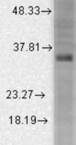 Western Blot: KCNMB3 Antibody (S40B-18) [NBP2-12916] - Rat brain membrane lysates using a 1:1000 dilution.