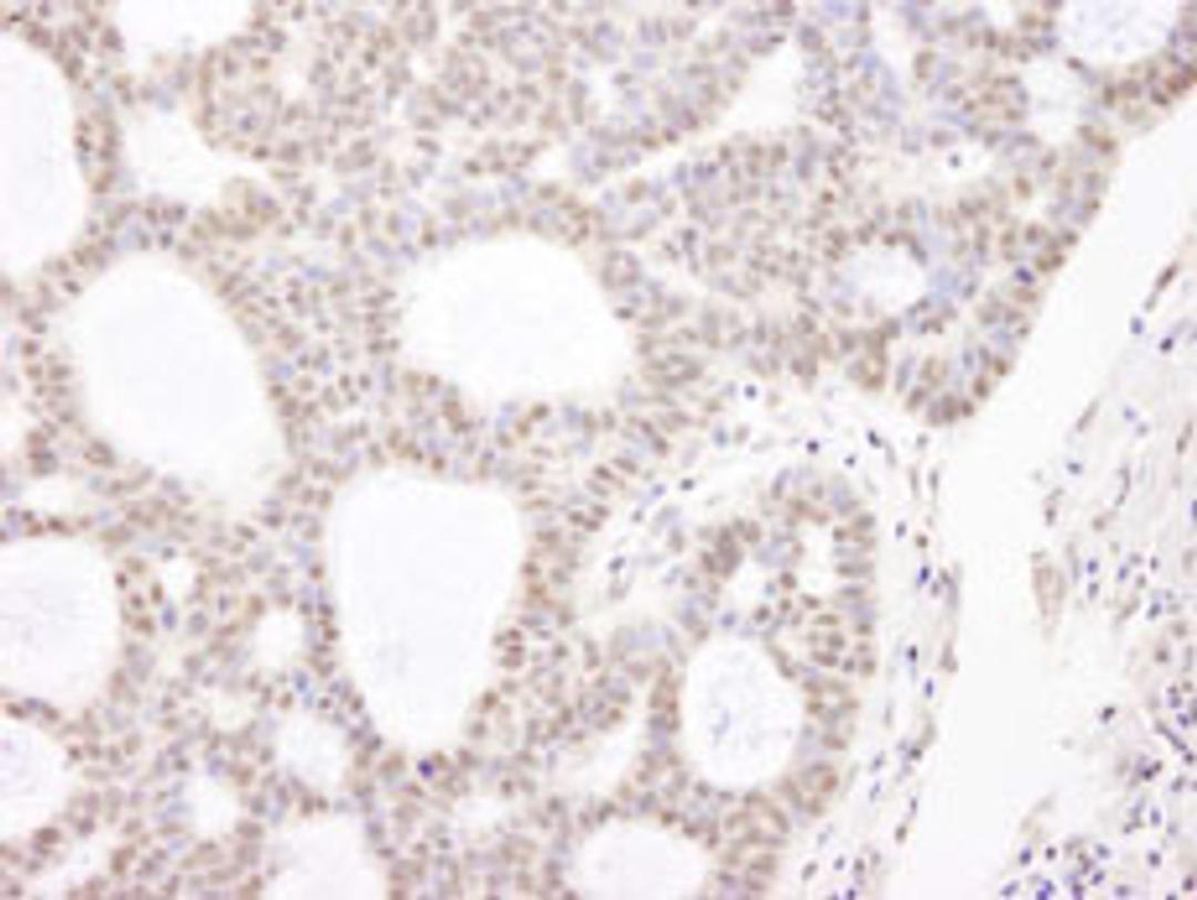 Detection of human CHD3 by immunohistochemistry.