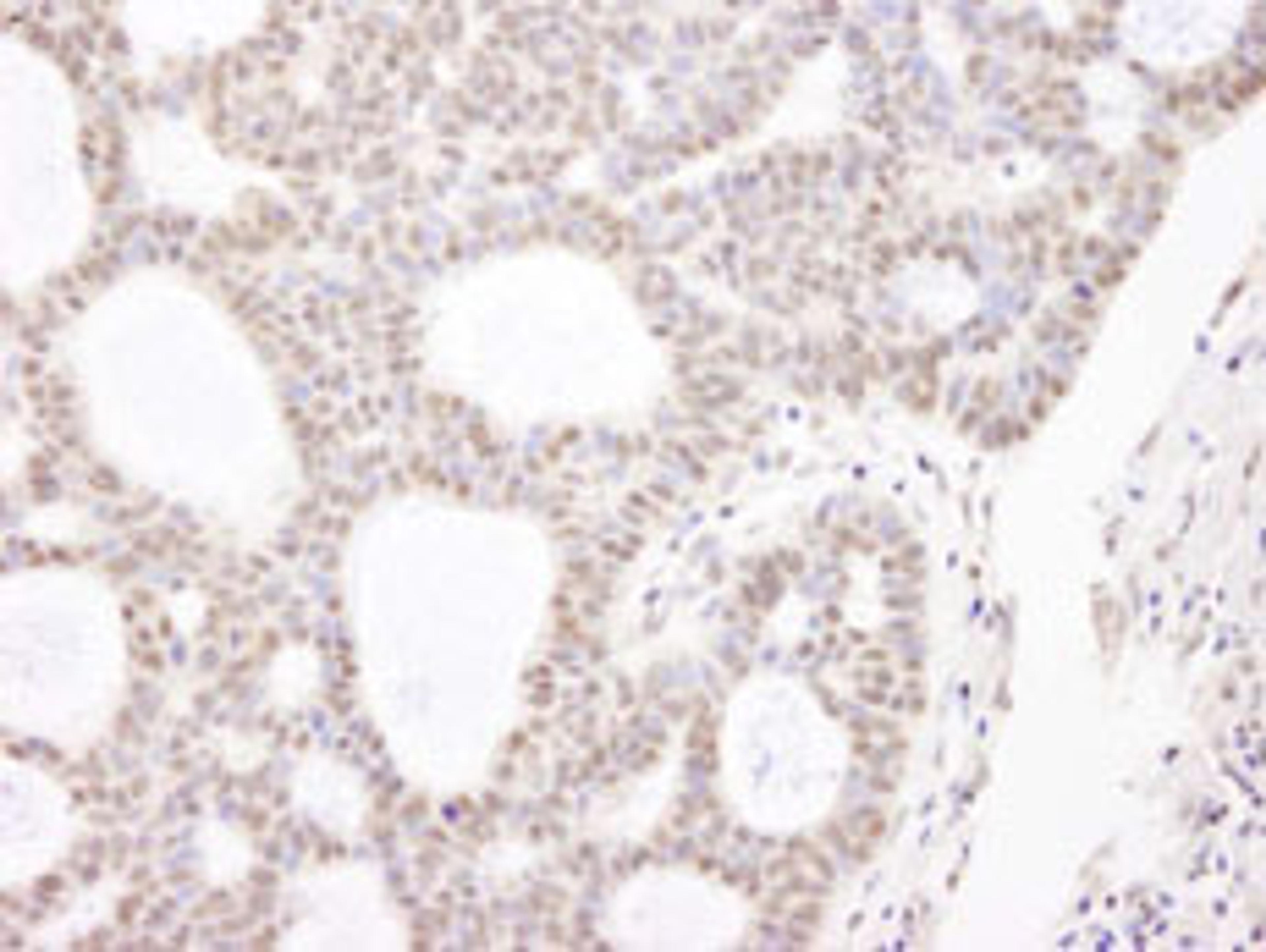 Detection of human CHD3 by immunohistochemistry.