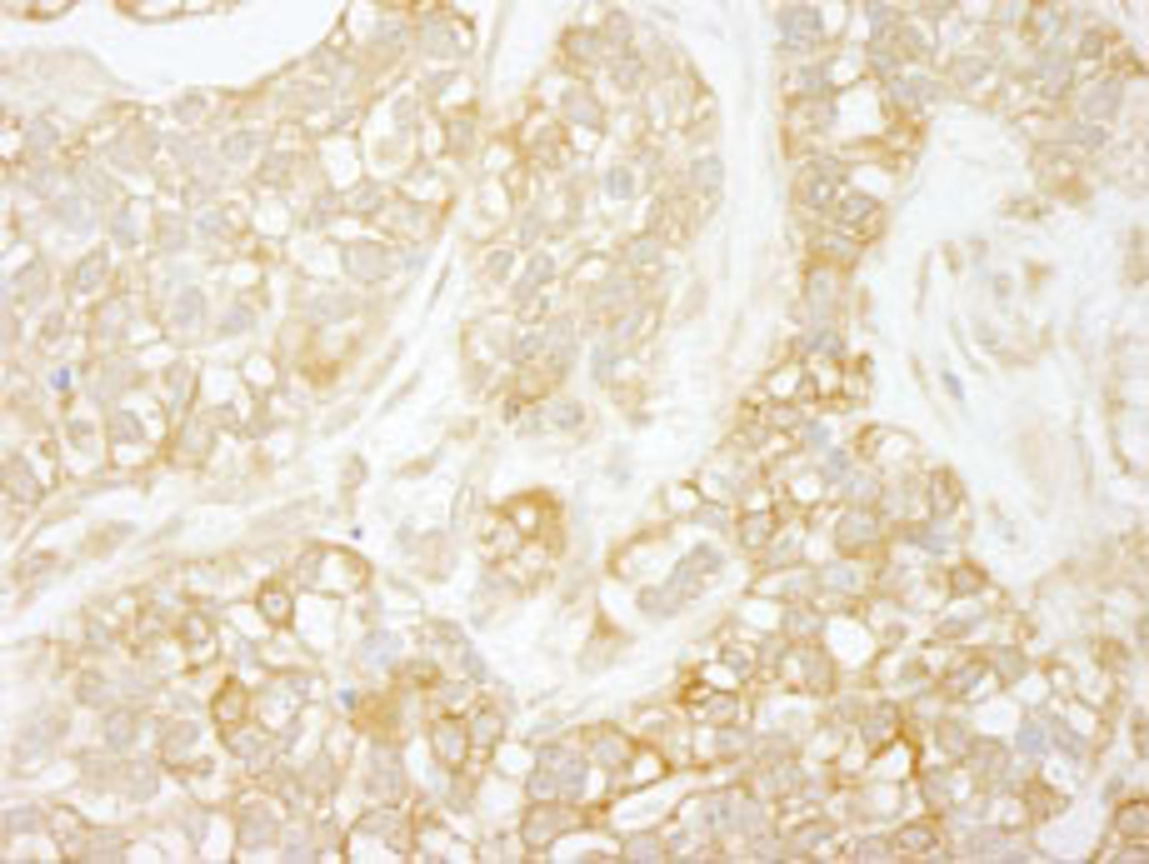 Detection of human RelA immunohistochemistry.