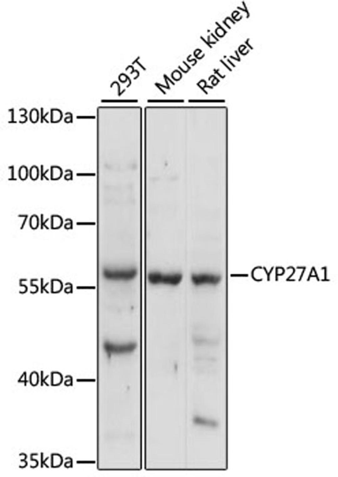 Western blot - CYP27A1 antibody (A1982)