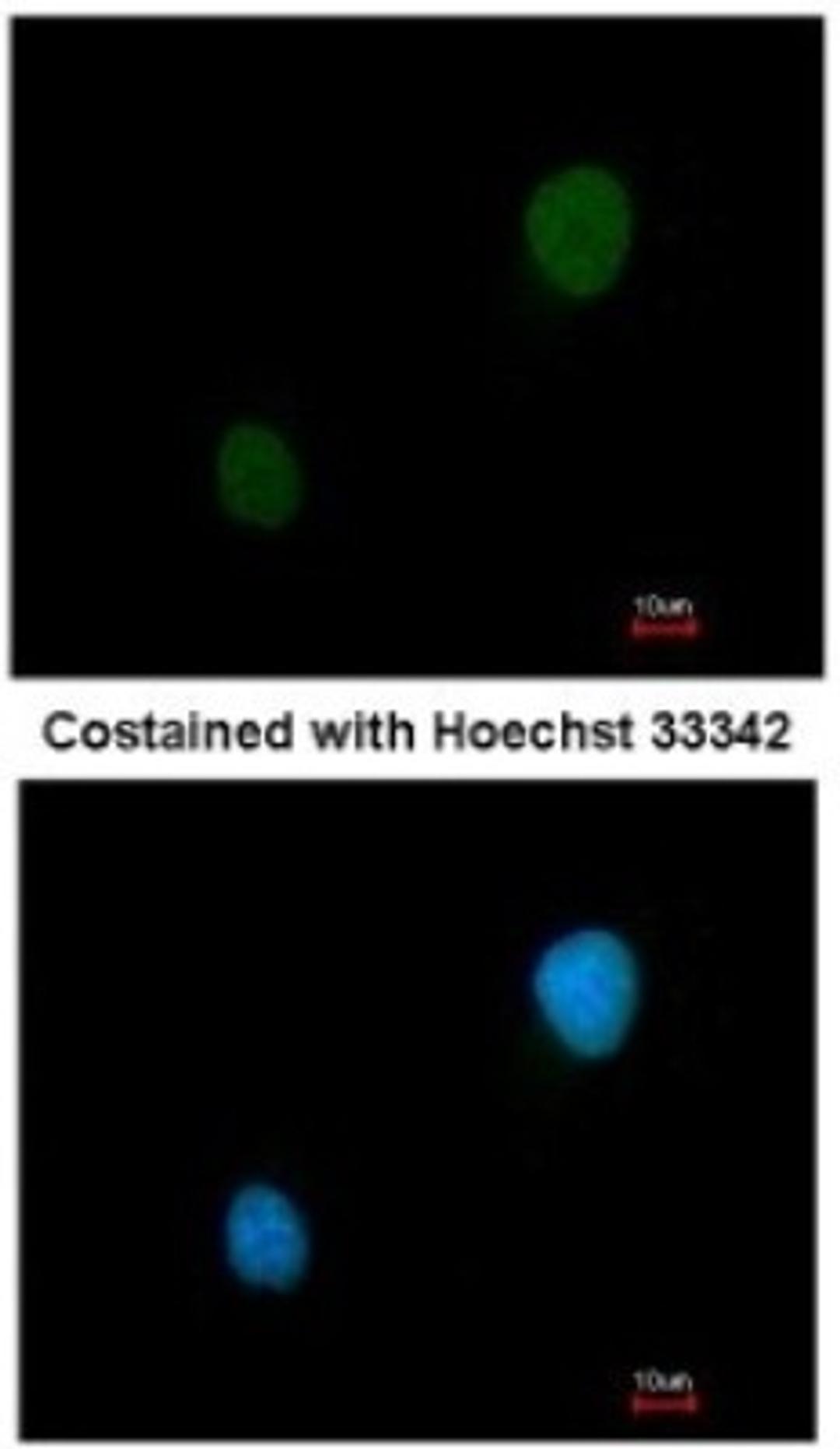 Immunocytochemistry/Immunofluorescence: PKA 2 beta Antibody [NBP1-33773] - Analysis of methanol-fixed HeLa, using antibody at 1:200 dilution.