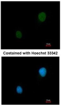 Immunocytochemistry/Immunofluorescence: PKA 2 beta Antibody [NBP1-33773] - Analysis of methanol-fixed HeLa, using antibody at 1:200 dilution.