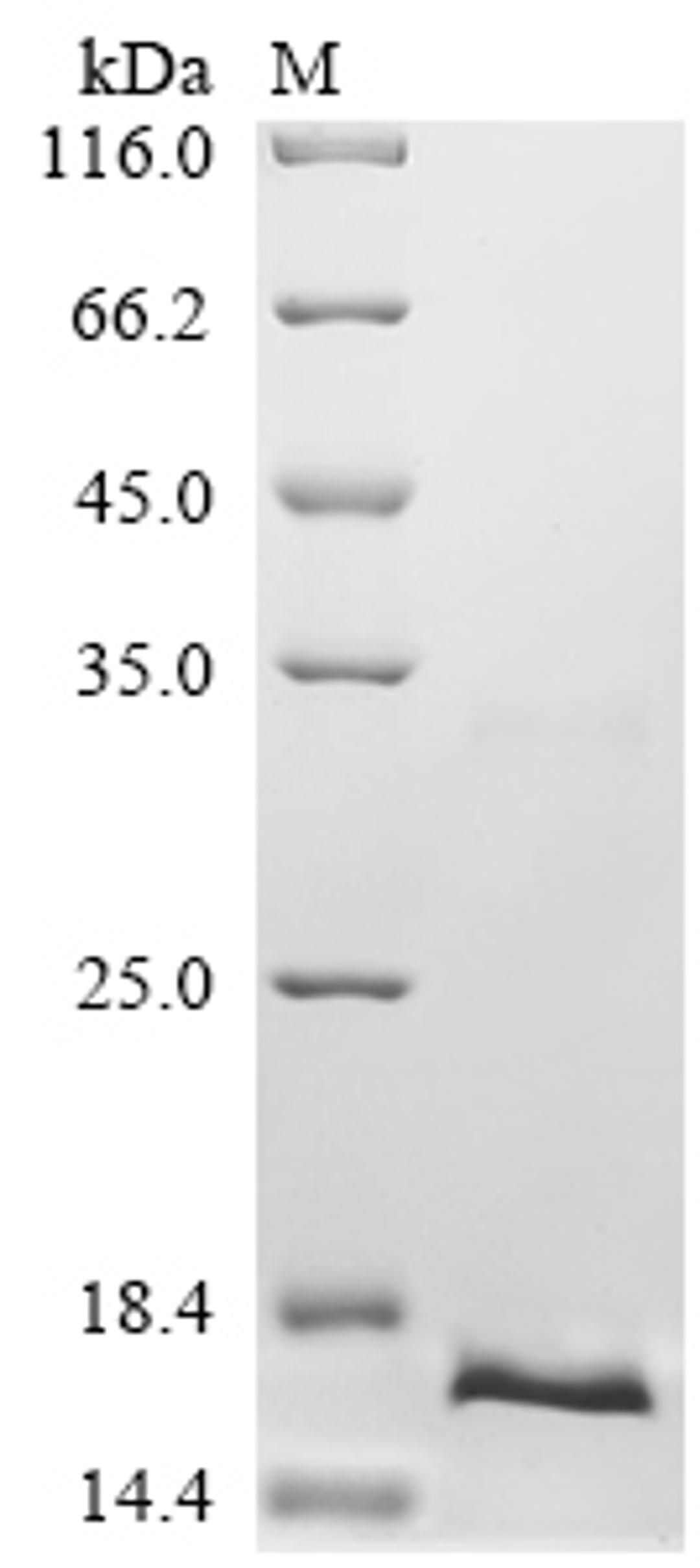 (Tris-Glycine gel) Discontinuous SDS-PAGE (reduced) with 5% enrichment gel and 15% separation gel.