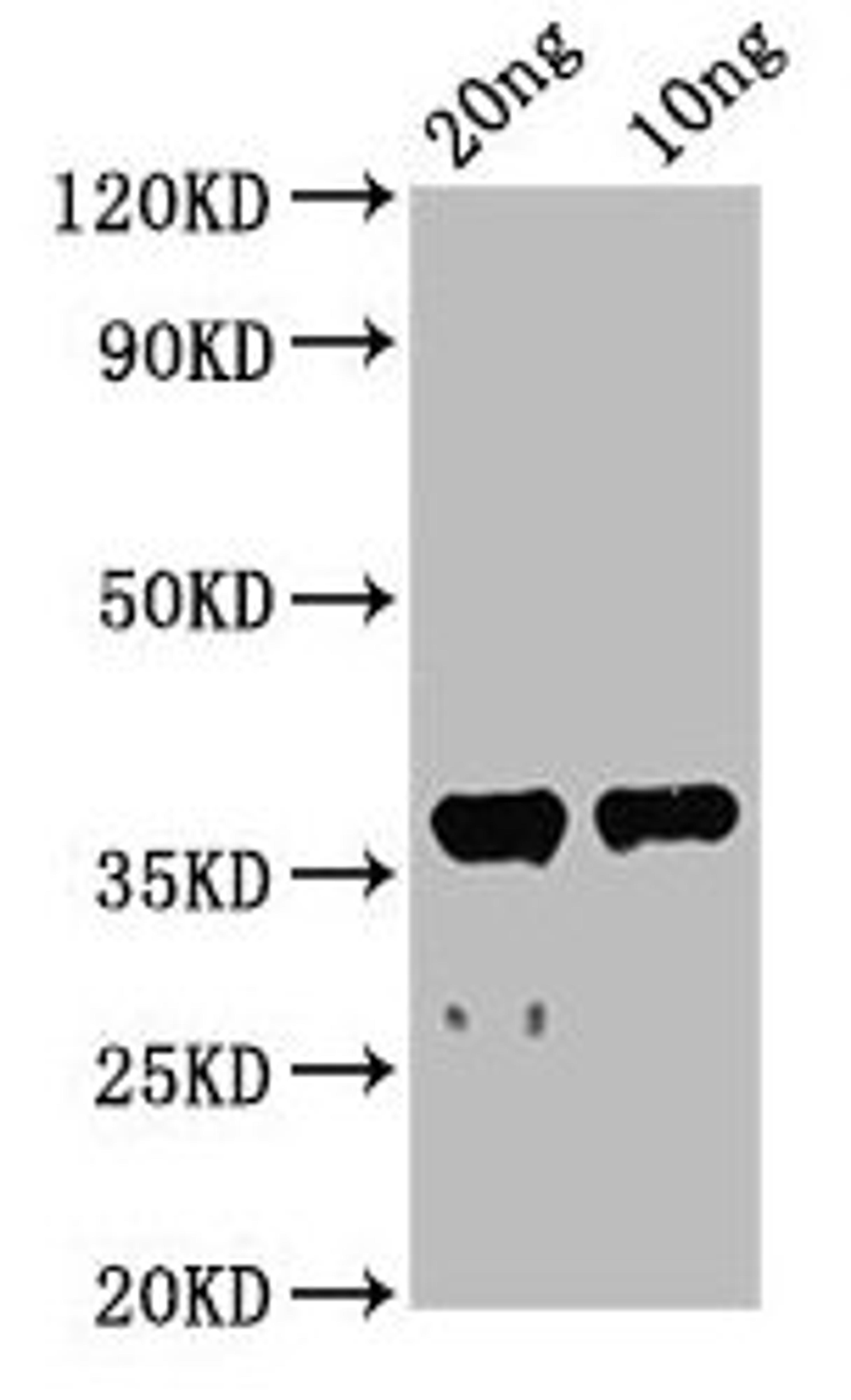 Western Blot. Positive WB detected in Recombinant protein. All lanes: ache antibody at 2.3µg/ml. Secondary. Goat polyclonal to rabbit IgG at 1/50000 dilution. Predicted band size: 44 kDa. Observed band size: 38 kDa