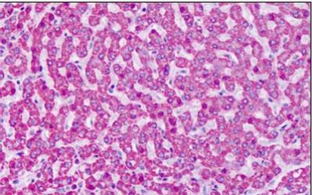 Immunohistochemistry-Paraffin: mGluR7 Antibody [NLS917] - Analysis of anti-GRM7 / MGLUR7 antibody with human liver at dilution 7 ug/ml.