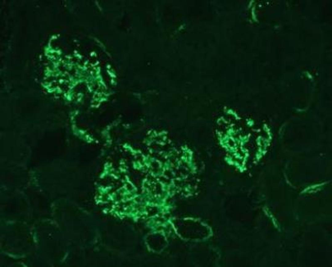 Immunocytochemistry/Immunofluorescence: Complement C3 Antibody (11H9) [NB200-540] - C3 protein fragments deposited on  kidney cells of MPL-lpr mouse. Staining with antibody 11H9. Glomerular staining pattern.