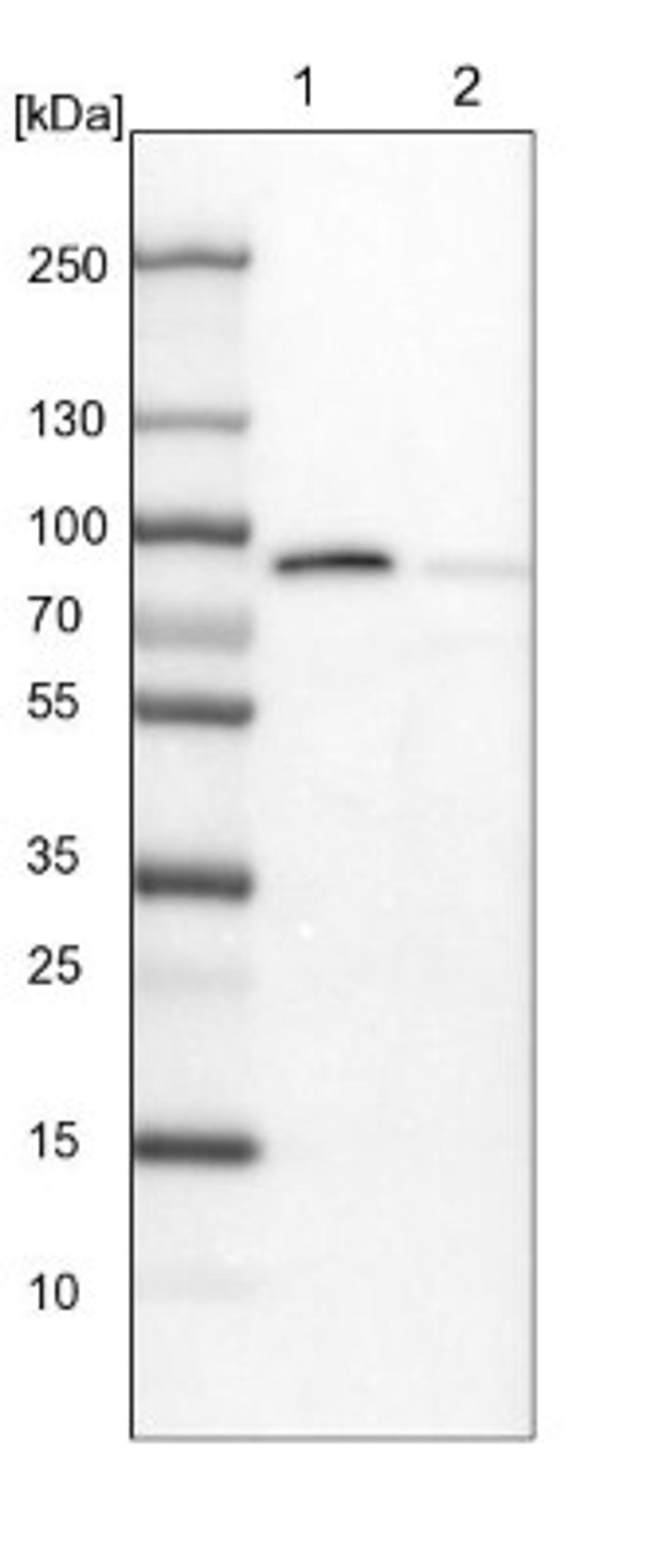 Western Blot: Invadolysin Antibody [NBP1-92025] - Lane 1: NIH-3T3 cell lysate (Mouse embryonic fibroblast cells)<br/>Lane 2: NBT-II cell lysate (Rat Wistar bladder tumour cells)