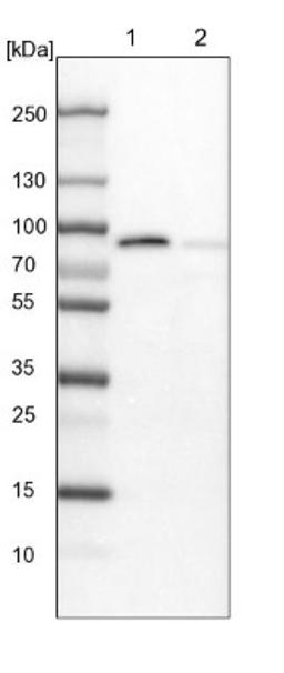 Western Blot: Invadolysin Antibody [NBP1-92025] - Lane 1: NIH-3T3 cell lysate (Mouse embryonic fibroblast cells)<br/>Lane 2: NBT-II cell lysate (Rat Wistar bladder tumour cells)