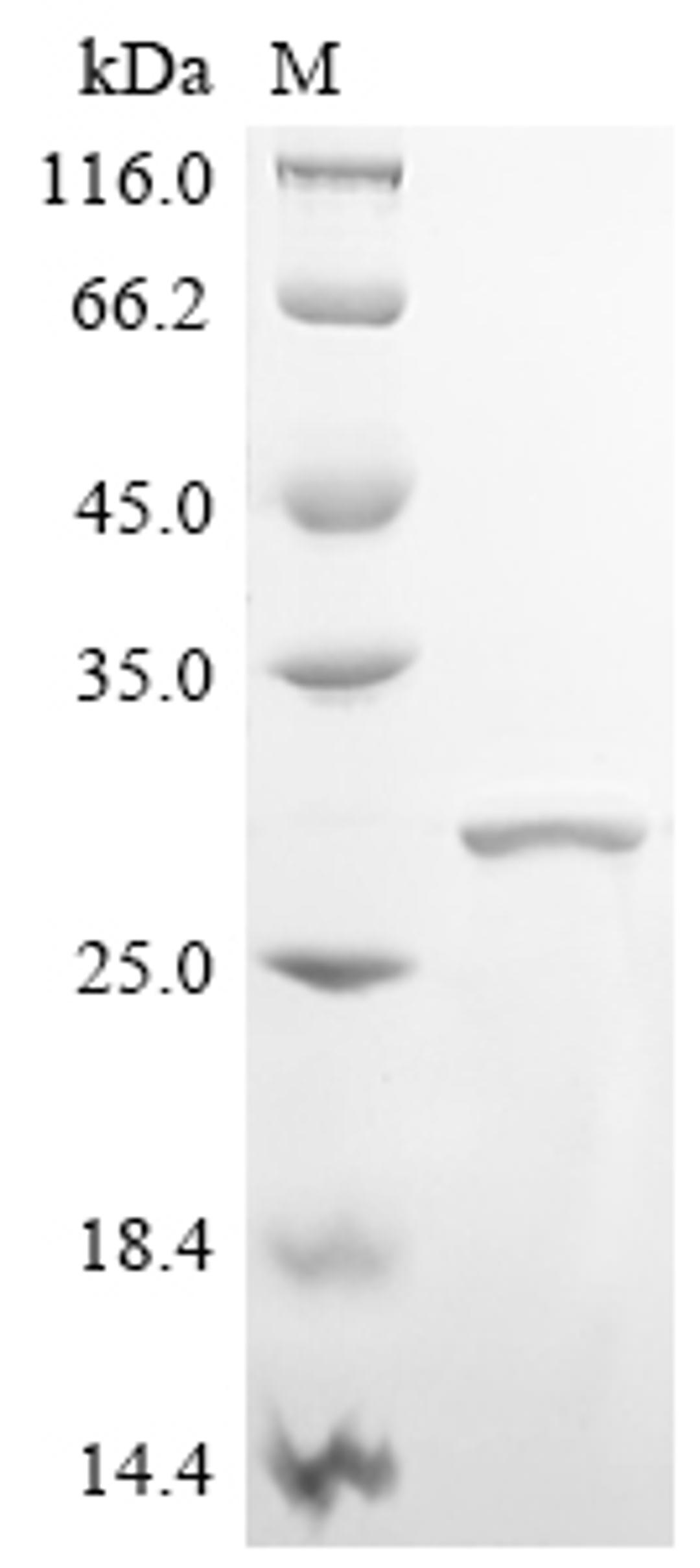 (Tris-Glycine gel) Discontinuous SDS-PAGE (reduced) with 5% enrichment gel and 15% separation gel.
