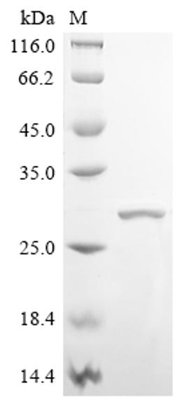 (Tris-Glycine gel) Discontinuous SDS-PAGE (reduced) with 5% enrichment gel and 15% separation gel.