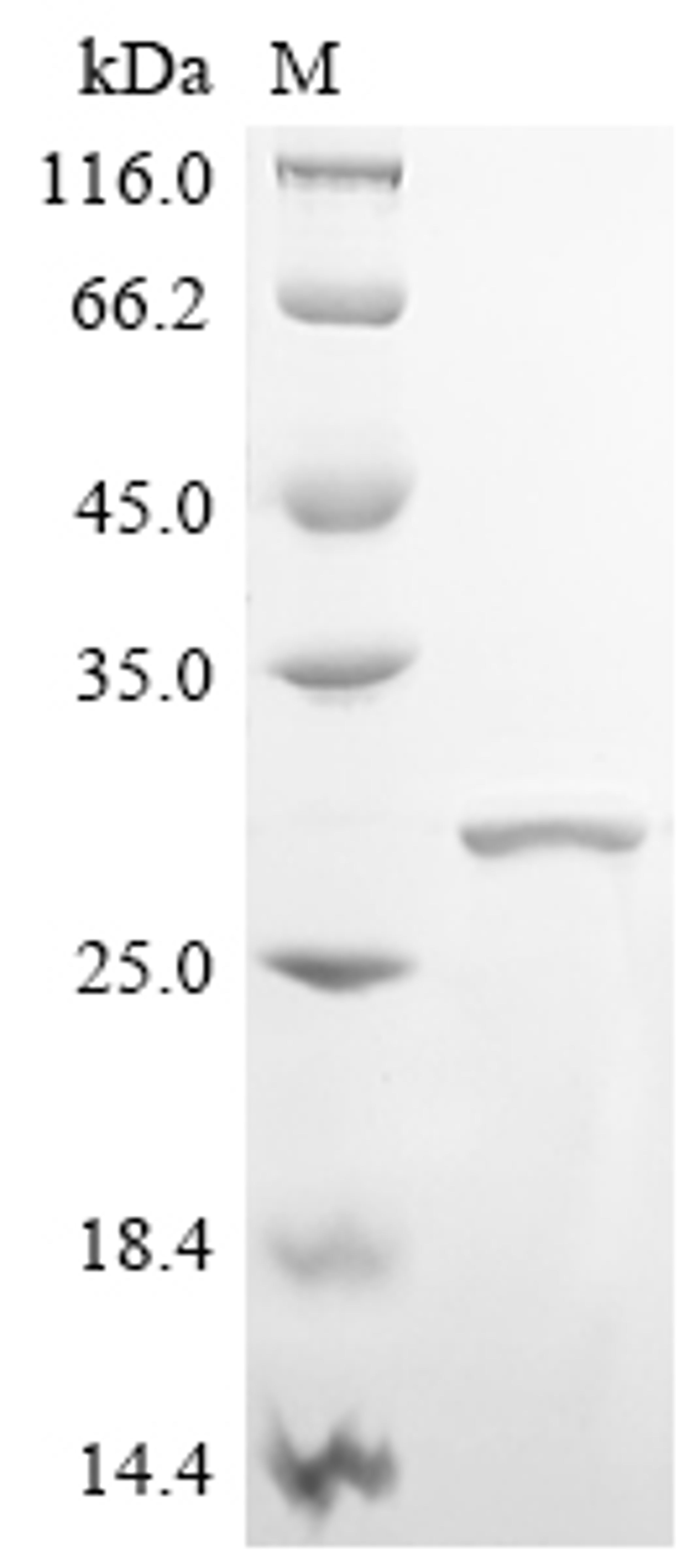 (Tris-Glycine gel) Discontinuous SDS-PAGE (reduced) with 5% enrichment gel and 15% separation gel.