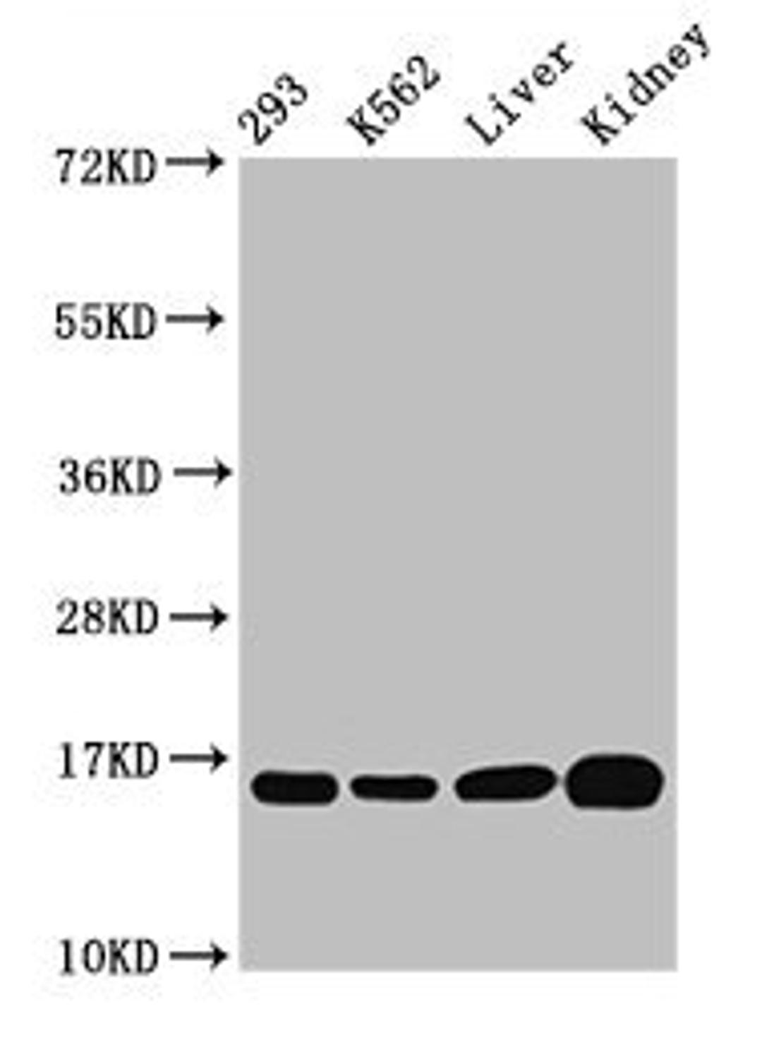 Western Blot. Positive WB detected in: 293 whole cell lysate, K562 whole cell lysate, Rat liver tissue, Mouse kidney tissue. All lanes: HIST1H3A antibody at 0.52µg/ml. Secondary. Goat polyclonal to rabbit IgG at 1/50000 dilution. Predicted band size: 16 kDa. Observed band size: 16 kDa