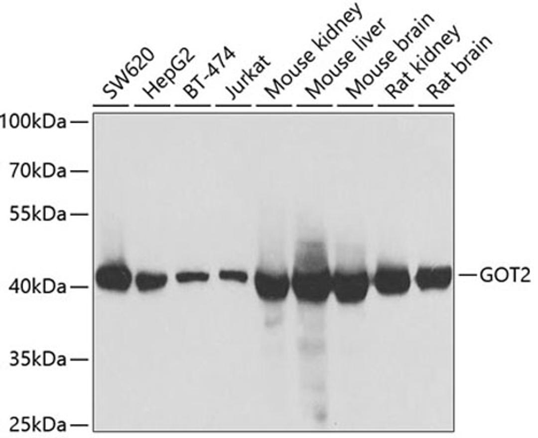 Western blot - GOT2 antibody (A6915)