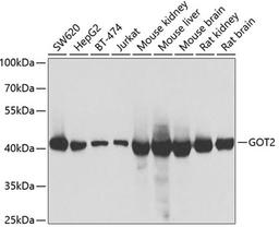 Western blot - GOT2 antibody (A6915)