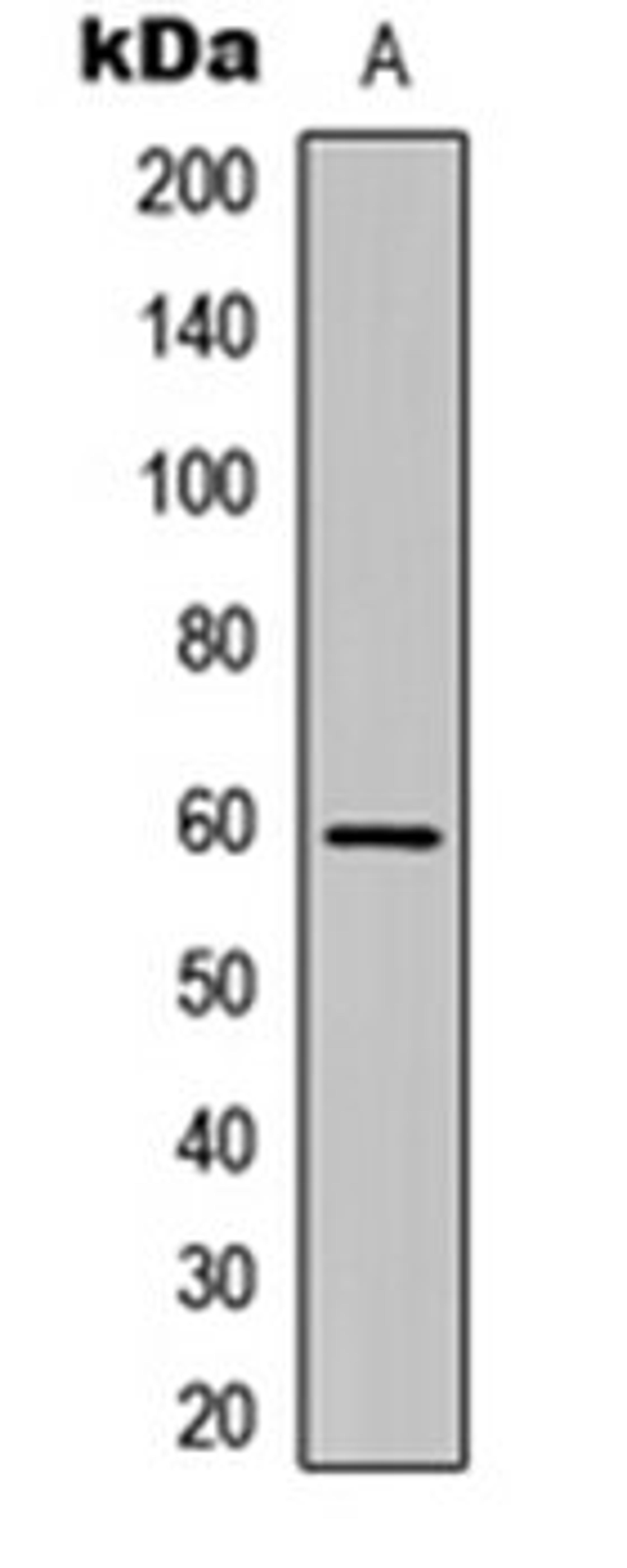 Western blot analysis of HEK293T (Lane 1) whole cell lysates using Cadherin 23 antibody