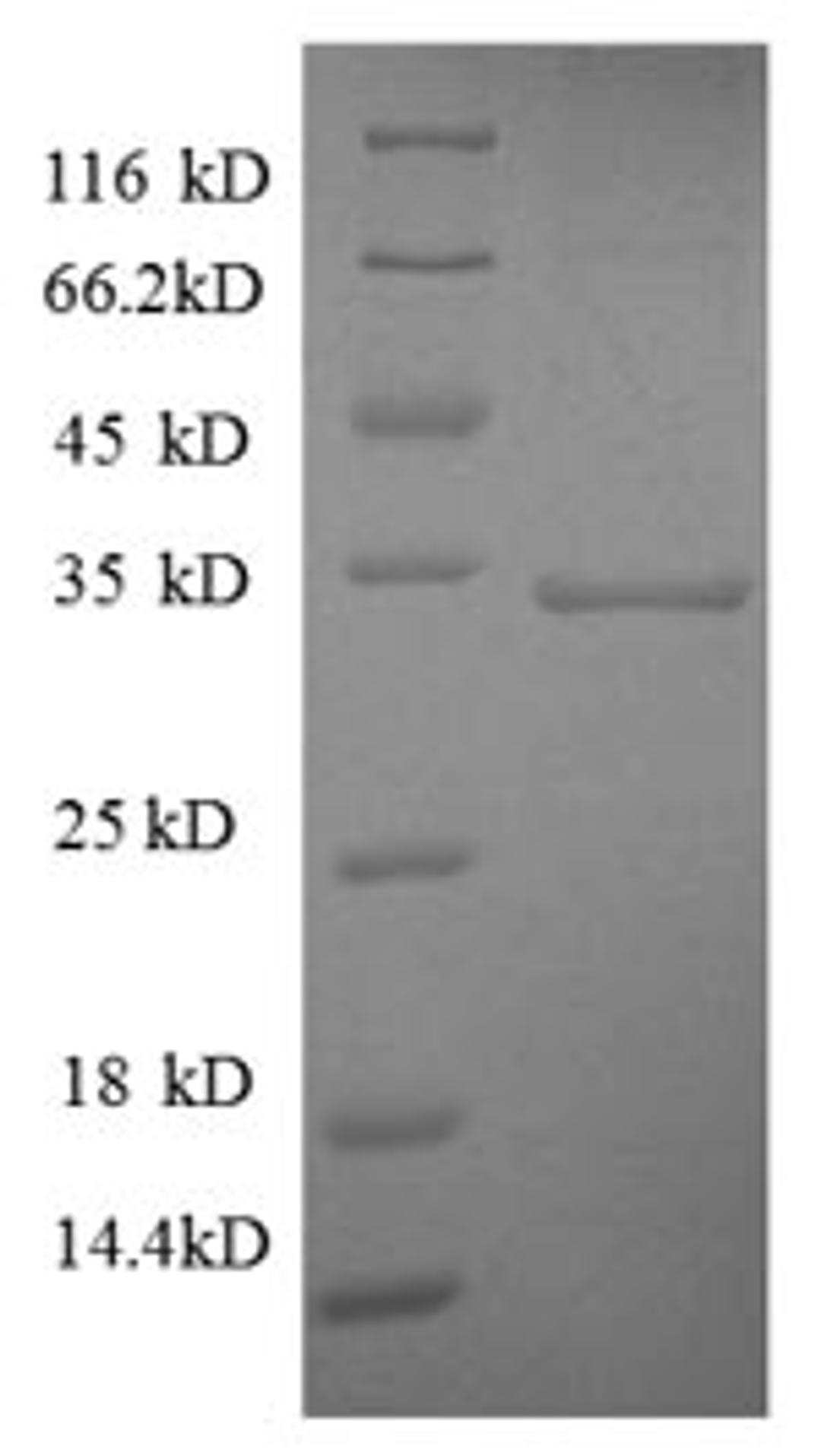 (Tris-Glycine gel) Discontinuous SDS-PAGE (reduced) with 5% enrichment gel and 15% separation gel.