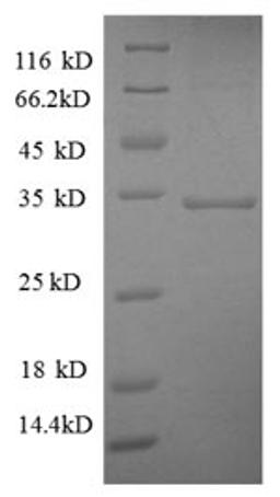 (Tris-Glycine gel) Discontinuous SDS-PAGE (reduced) with 5% enrichment gel and 15% separation gel.