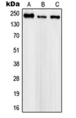 Western blot analysis of SHSY5Y (Lane 1), mouse brain (Lane 2), PC12 (Lane 3) whole cell lysates using SCN1A antibody