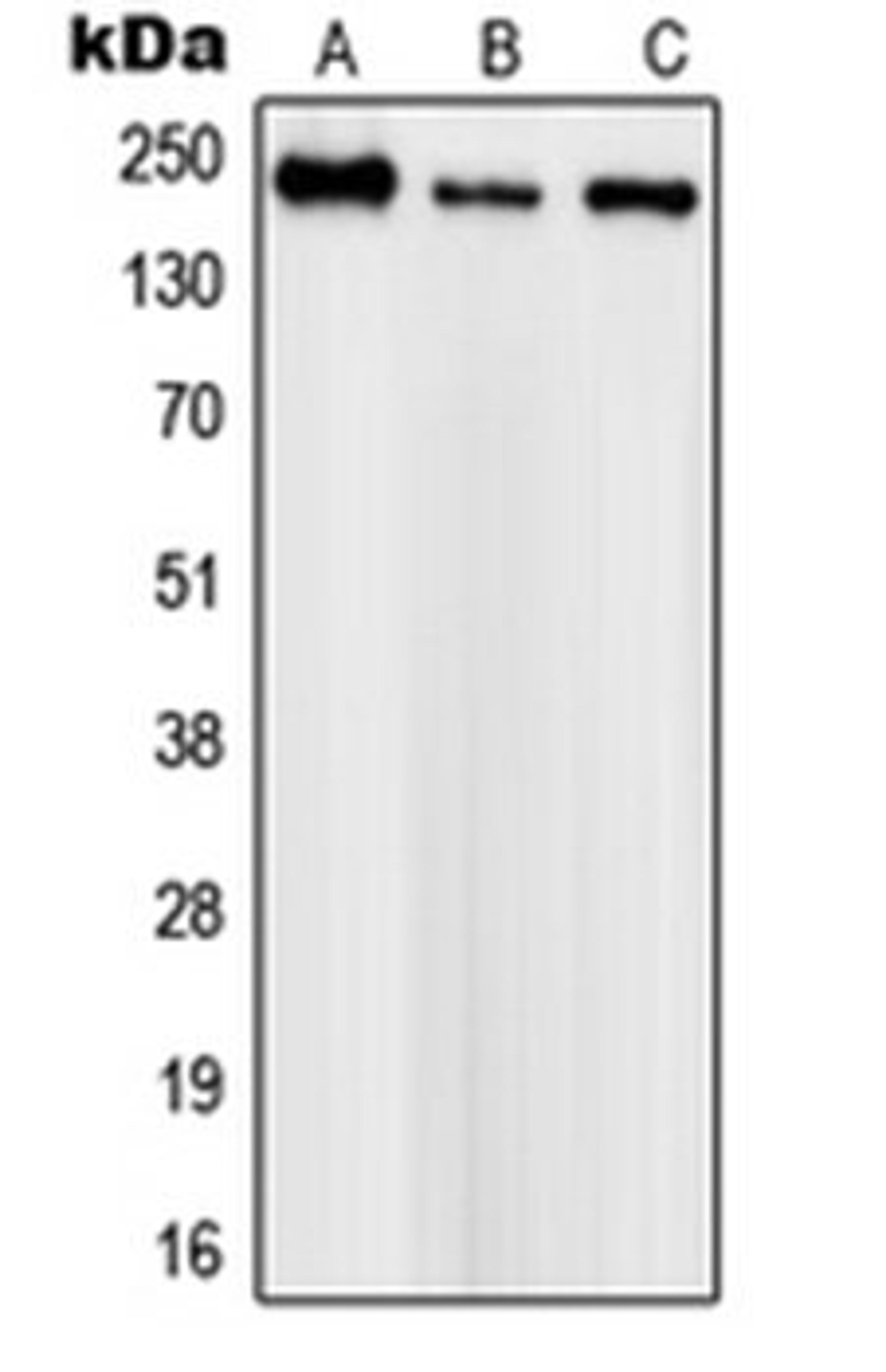 Western blot analysis of SHSY5Y (Lane 1), mouse brain (Lane 2), PC12 (Lane 3) whole cell lysates using SCN1A antibody