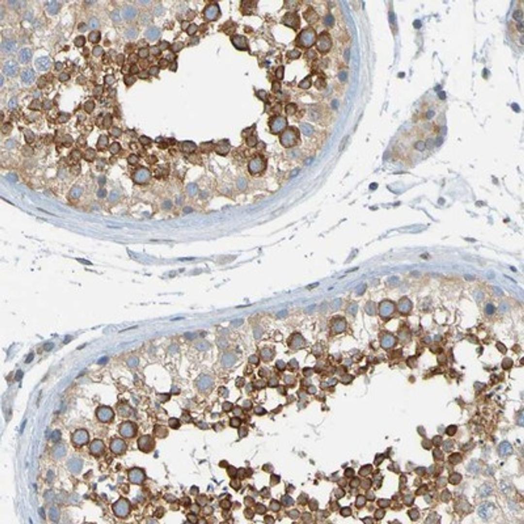 Immunohistochemistry-Paraffin: MAG Antibody [NBP1-81817] Staining of human testis shows strong cytoplasmic positivity in a subset of cells in seminiferus ducts.