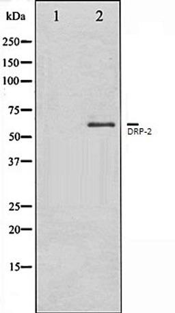 Western blot analysis of A549 whole cell lysates using DRP-2 antibody, The lane on the left is treated with the antigen-specific peptide.