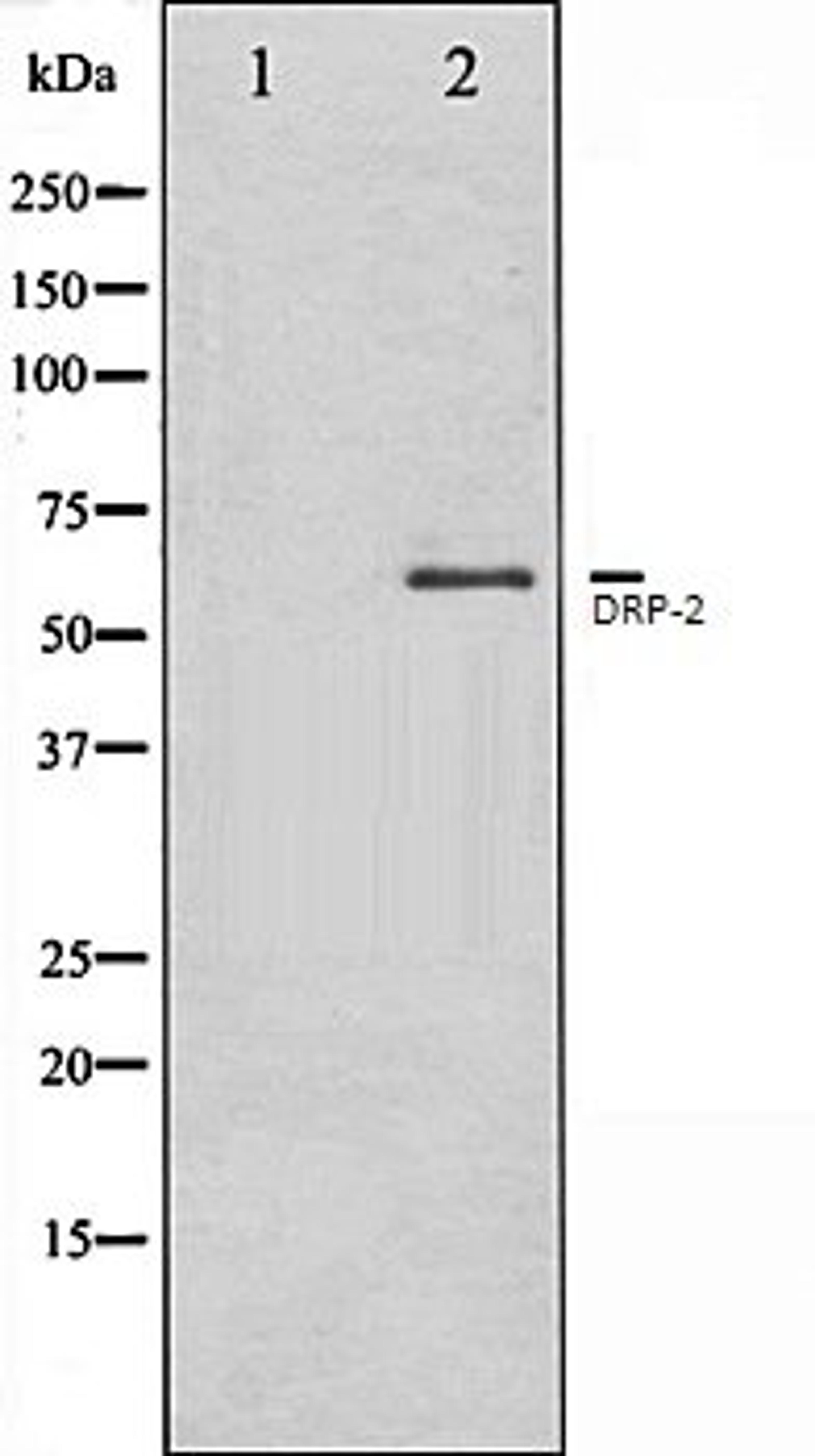 Western blot analysis of A549 whole cell lysates using DRP-2 antibody, The lane on the left is treated with the antigen-specific peptide.