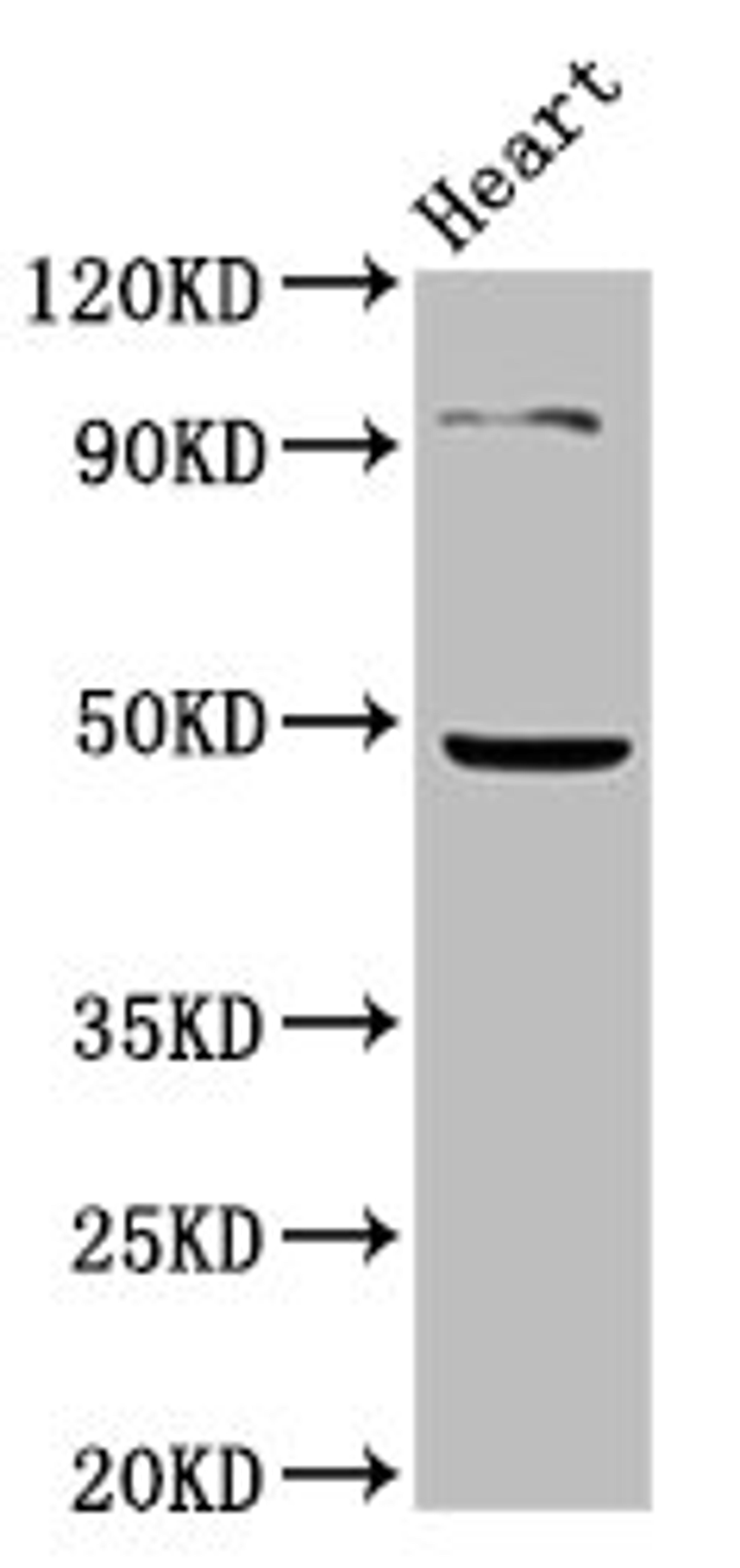 Western Blot. Positive WB detected in: Mouse heart tissue. All lanes: KCNJ5 antibody at 4.85ug/ml. Secondary. Goat polyclonal to rabbit IgG at 1/50000 dilution. Predicted band size: 48 kDa. Observed band size: 48 kDa.