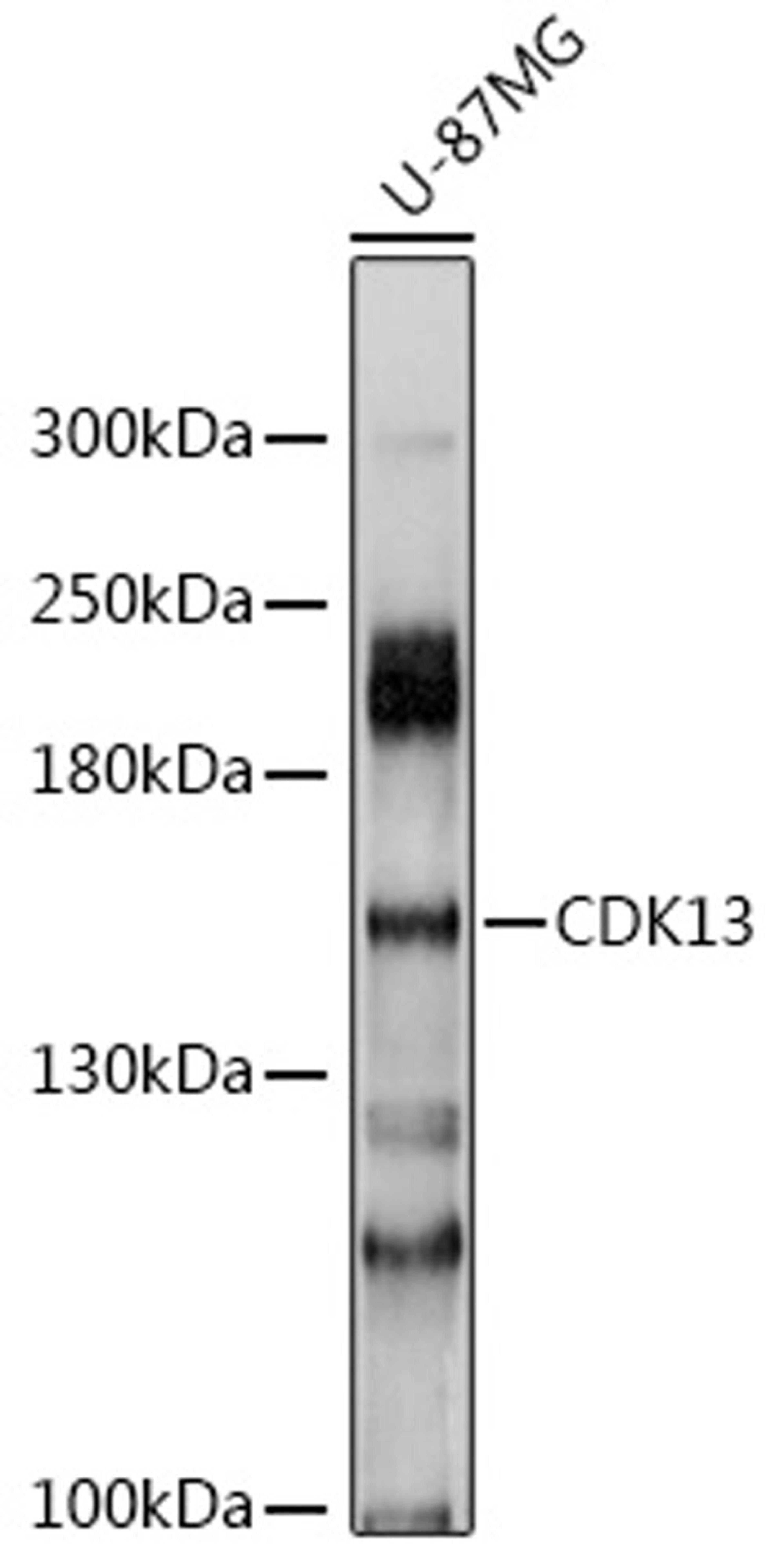 Western blot - CDK13 antibody (A10258)