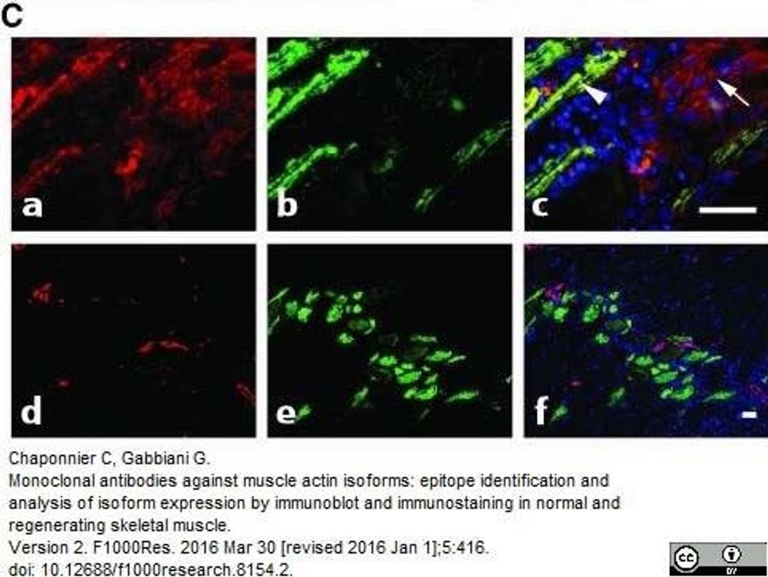 Mouse anti Human alpha actin antibody used to demonstrate actin isoform expression