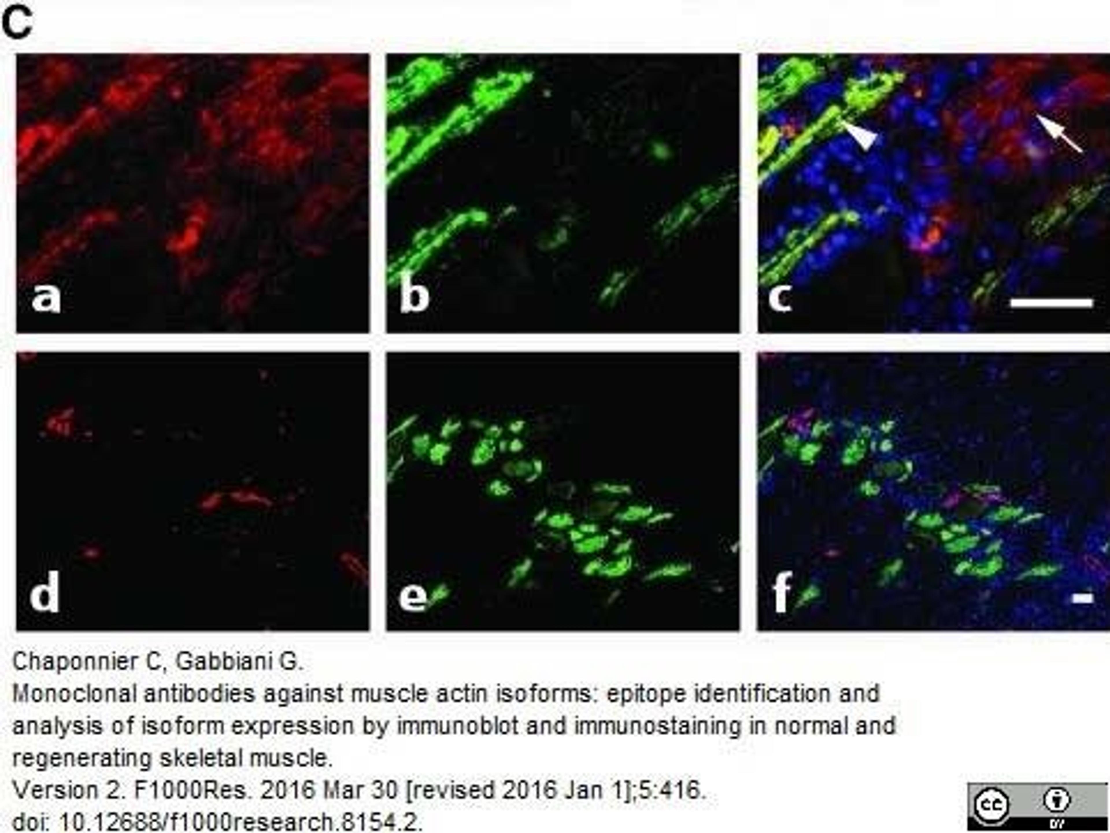 Mouse anti Human alpha actin antibody used to demonstrate actin isoform expression