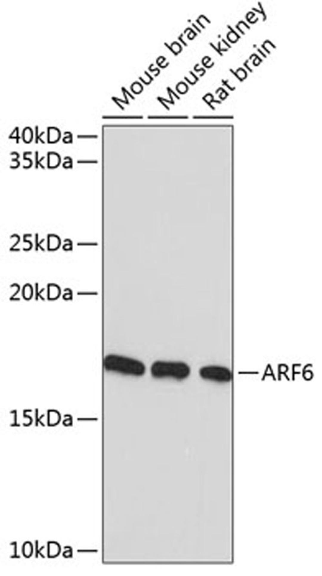 Western blot - ARF6 Rabbit mAb (A11485)