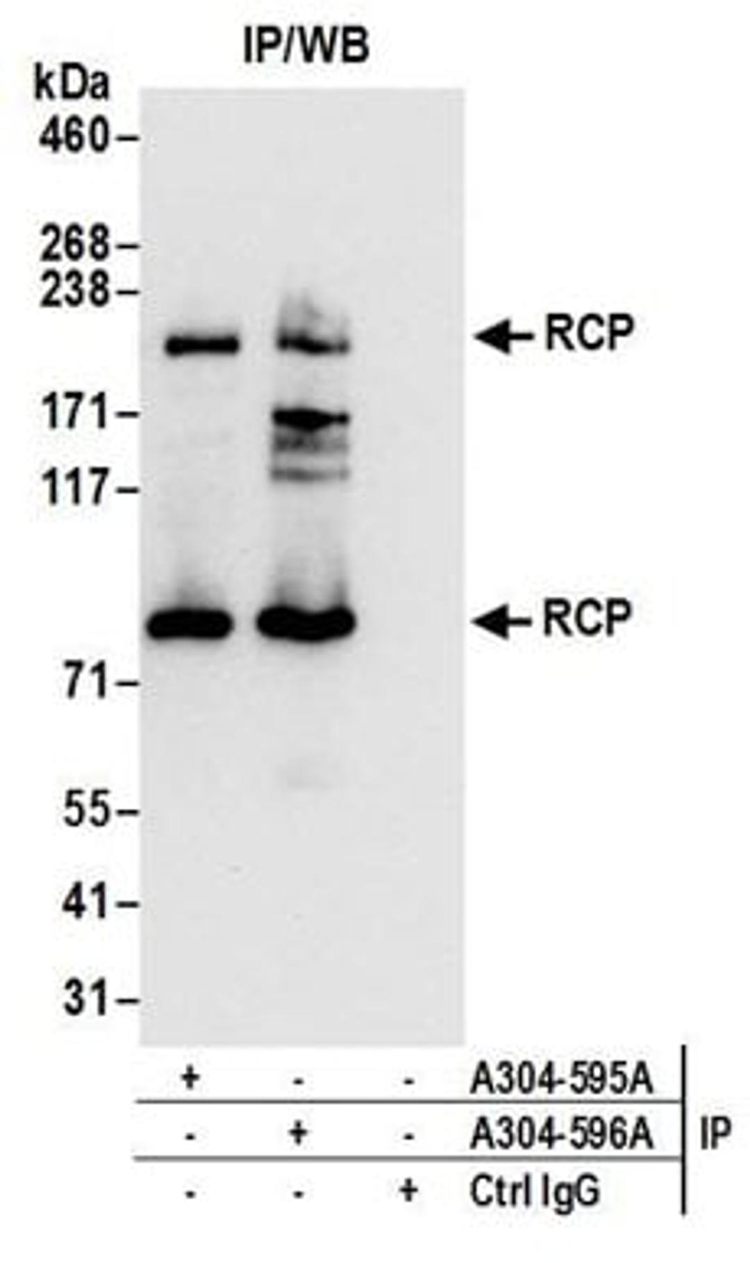 Detection of human RCP by western blot of immunoprecipitates.