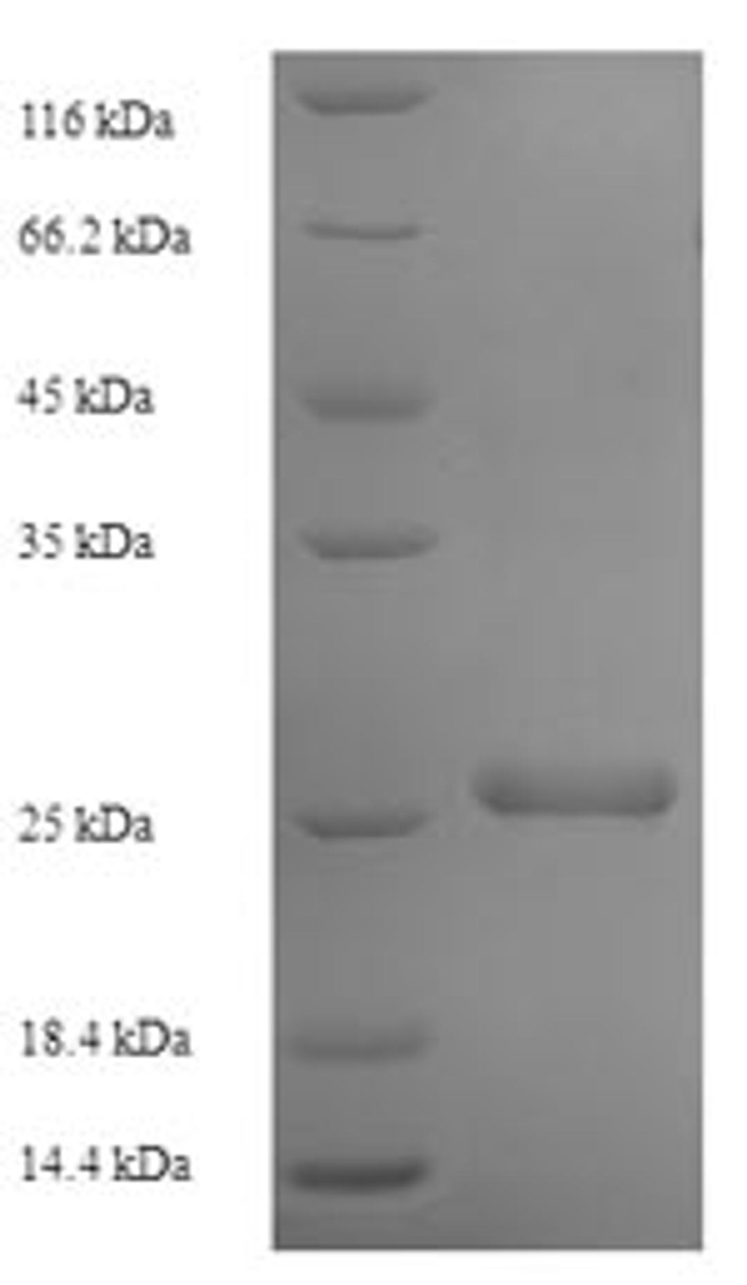 (Tris-Glycine gel) Discontinuous SDS-PAGE (reduced) with 5% enrichment gel and 15% separation gel.