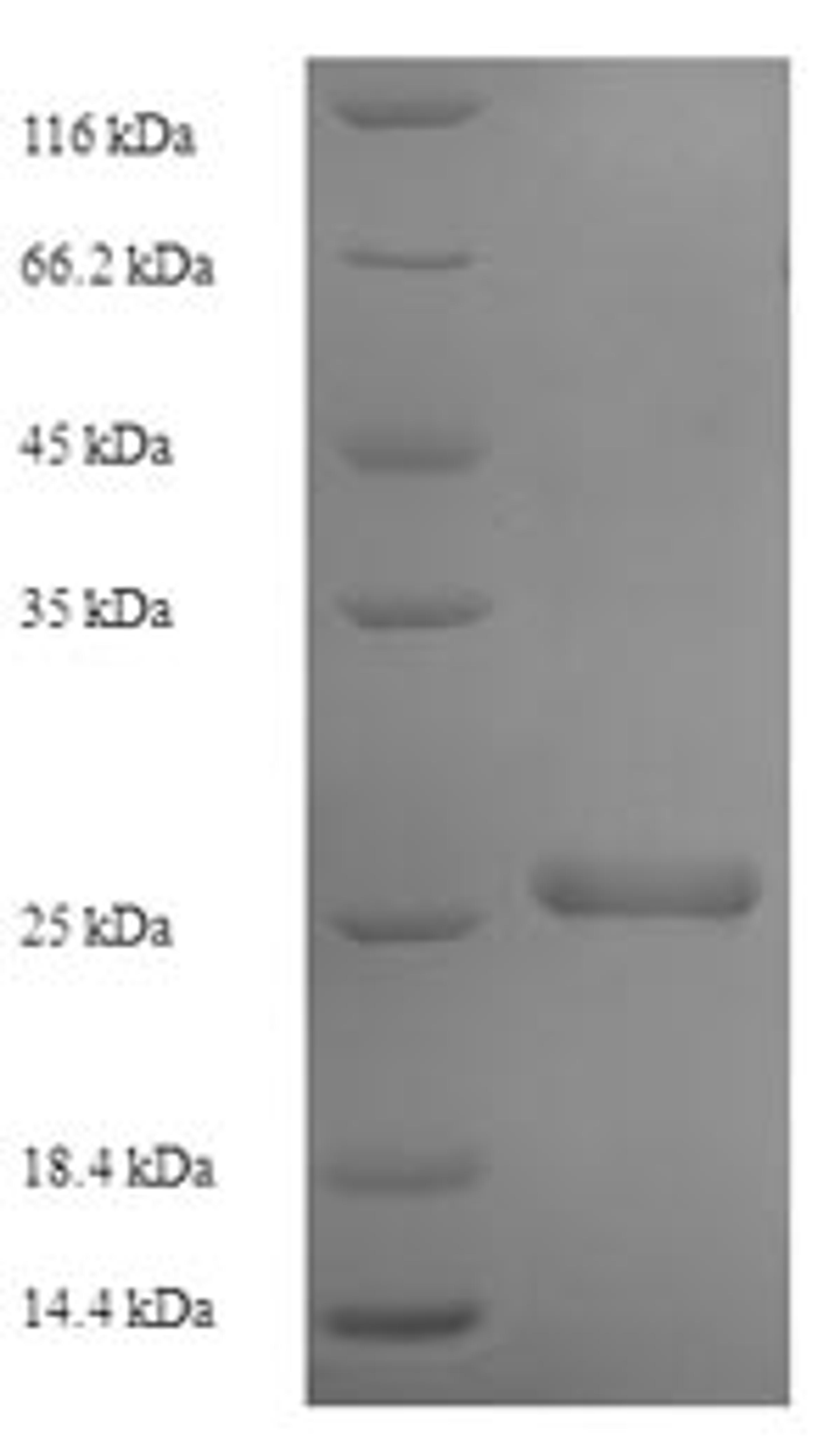 (Tris-Glycine gel) Discontinuous SDS-PAGE (reduced) with 5% enrichment gel and 15% separation gel.