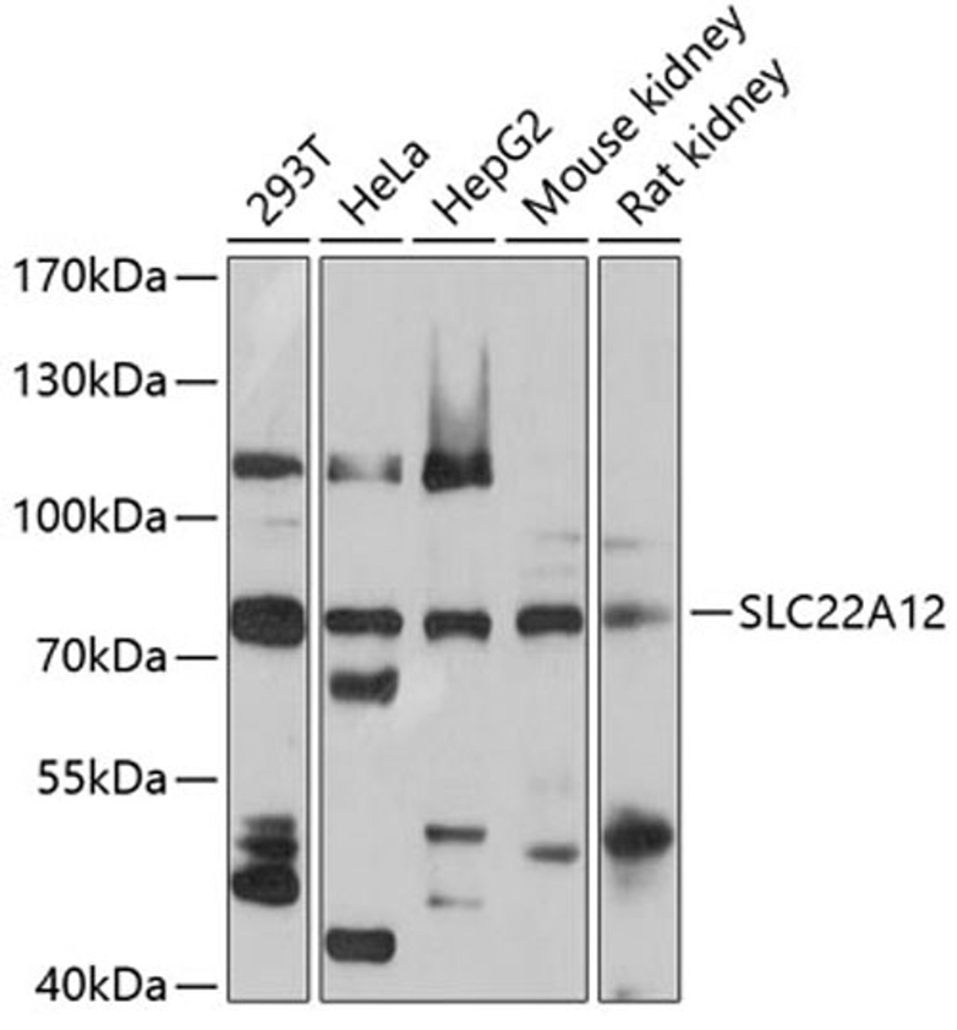 Western blot - SLC22A12 antibody (A5118)