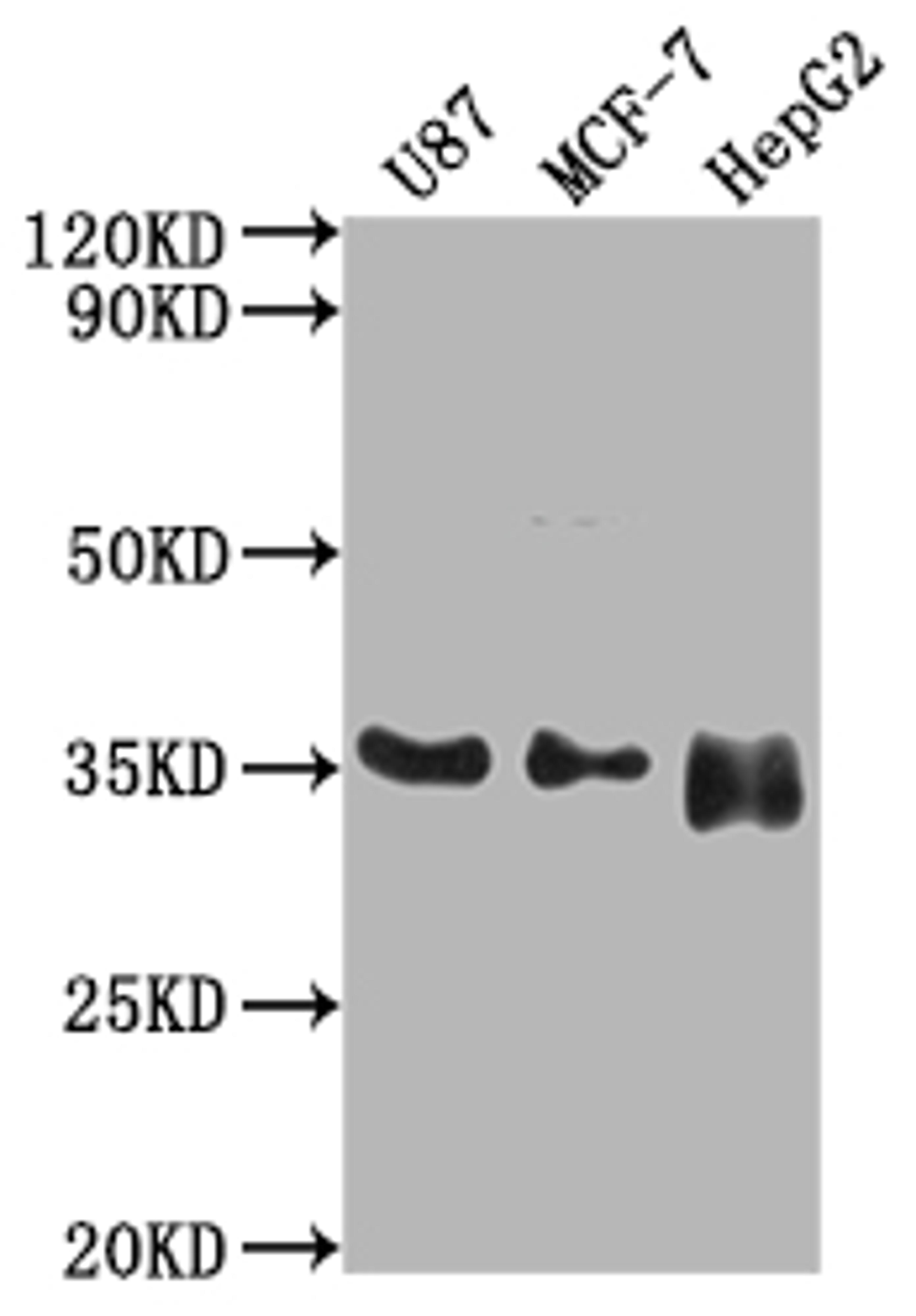 Western Blot. Positive WB detected in: U87 whole cell lysate, MCF-7 whole cell lysate, HepG2 whole cell lysate. All lanes: HMGCL antibody at 1:2000. Secondary. Goat polyclonal to rabbit IgG at 1/50000 dilution. Predicted band size: 35, 27, 21 kDa. Observed band size: 35 kDa.