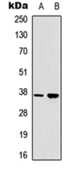 Western blot analysis of HeLa UV-treated (Lane 1), HEK293T UV-treated (Lane 2) whole cell lysates using RAD51A (Phospho-Y315) antibody