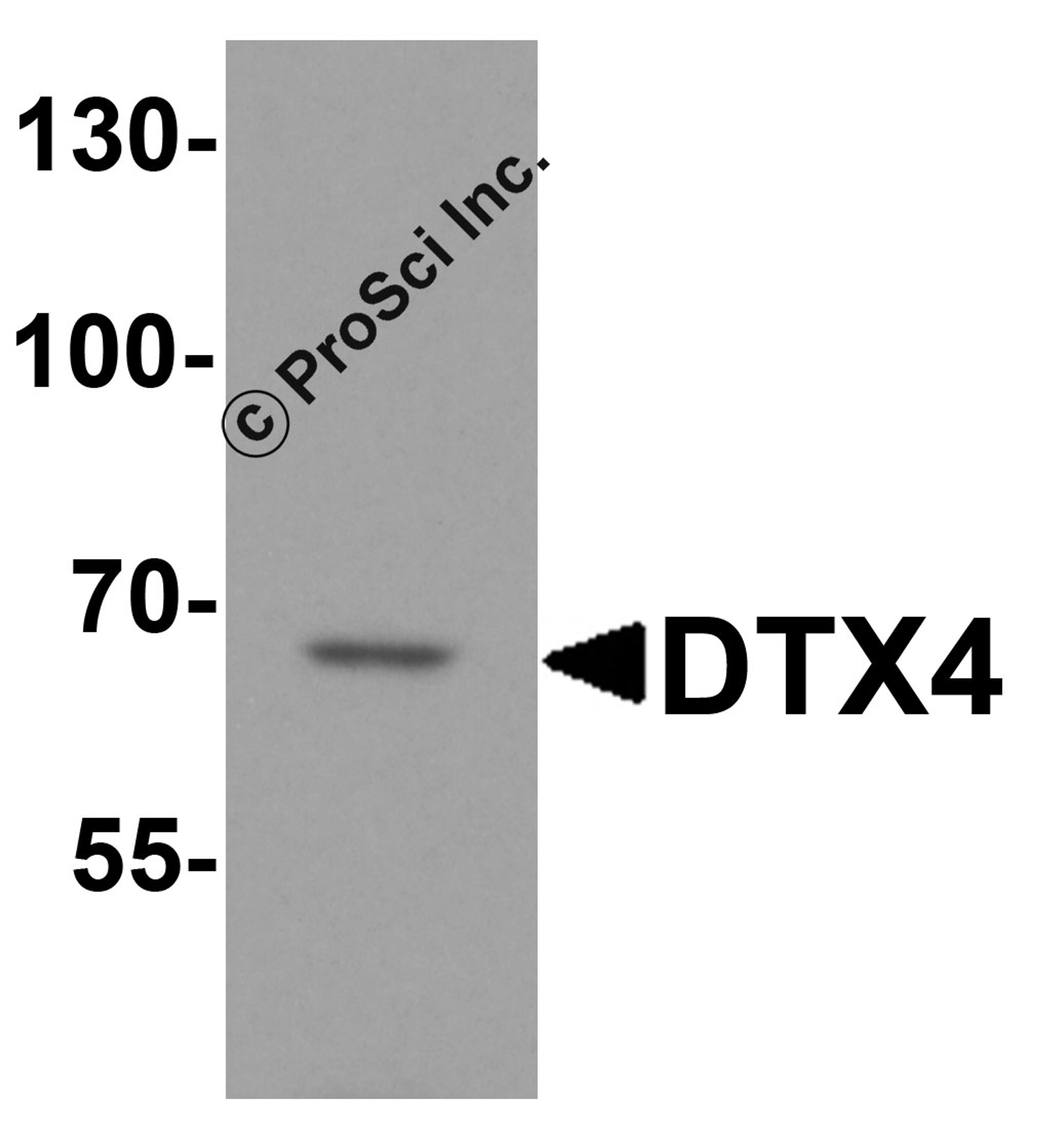 Western blot analysis of DTX4 in HeLa cell lysate with DTX4 antibody at 1 μg/ml.