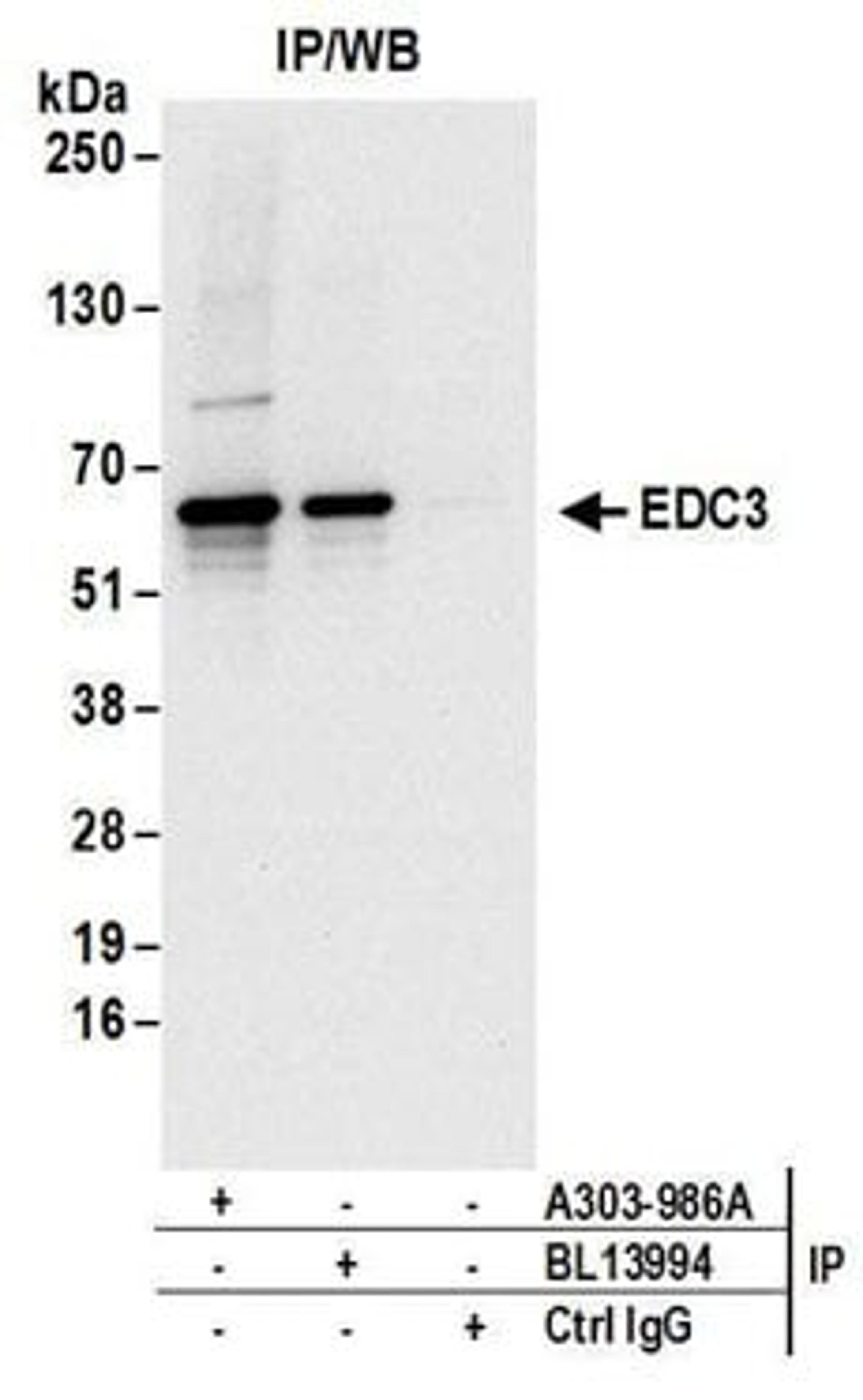 Detection of human EDC3 by western blot of immunoprecipitates.