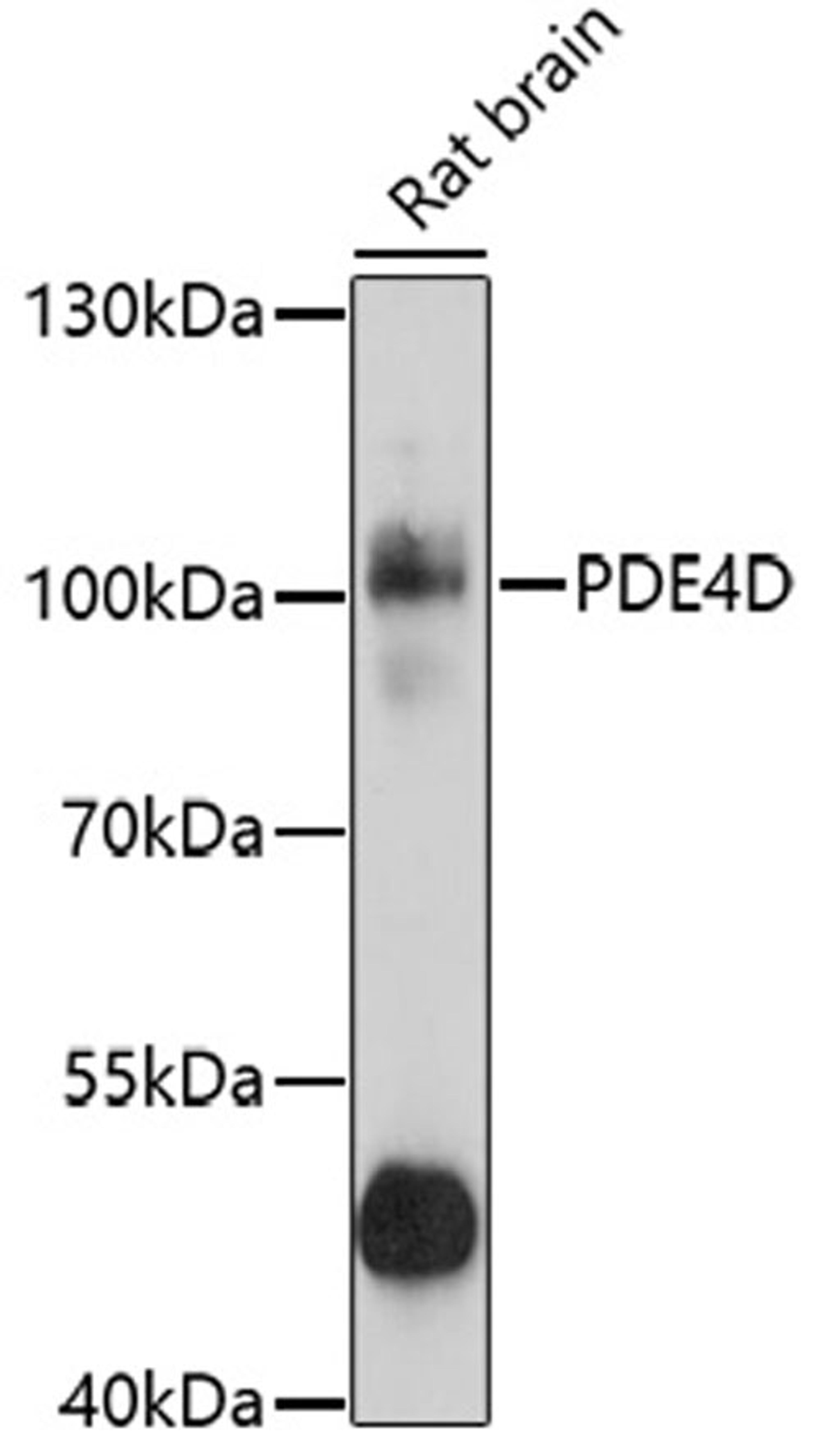 Western blot - PDE4D antibody (A1659)