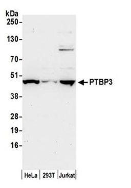 Detection of human PTBP3 by western blot.