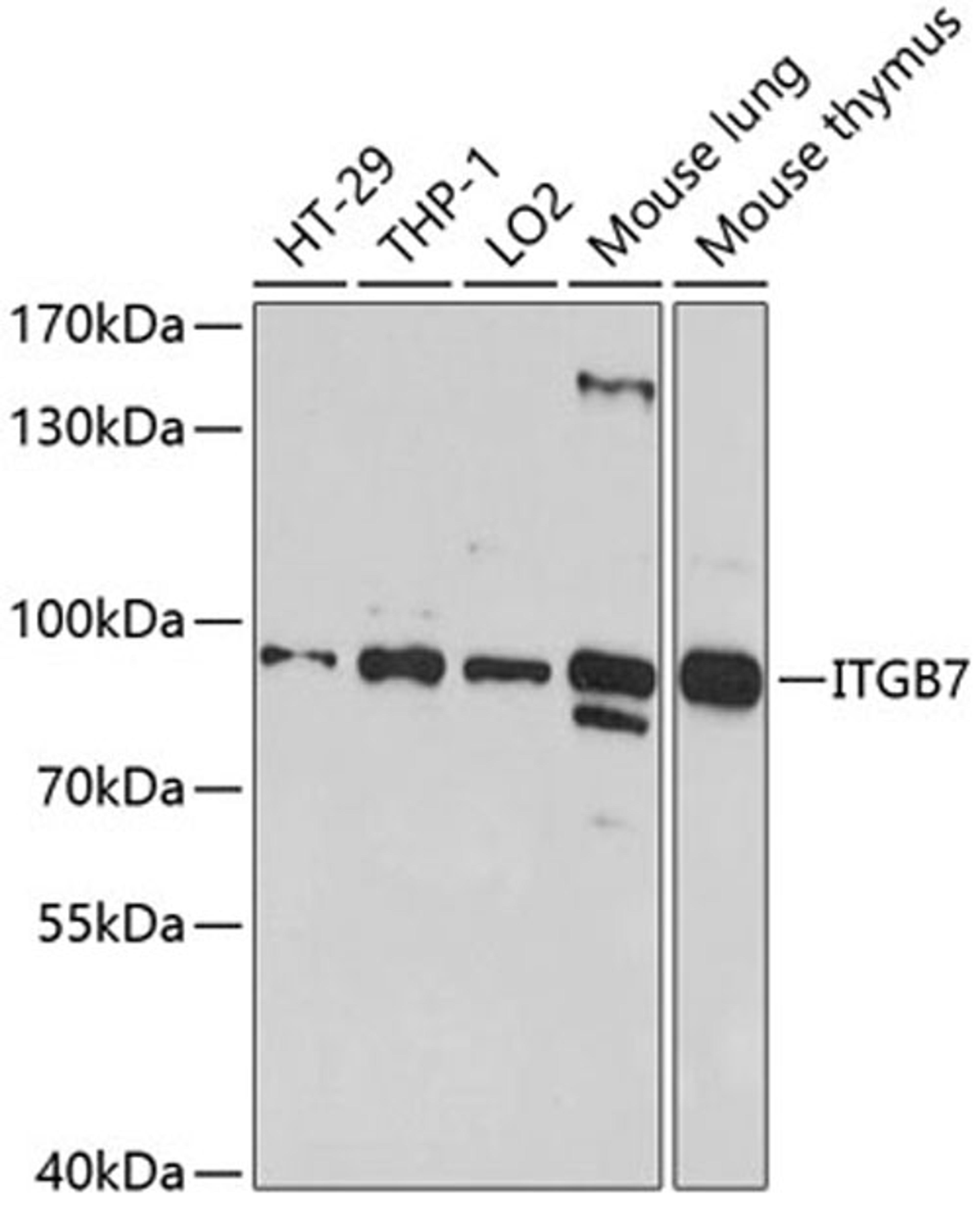 Western blot - ITGB7 antibody (A5873)