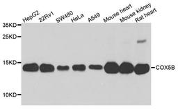 Western blot analysis of extract of various cells using COX5B antibody