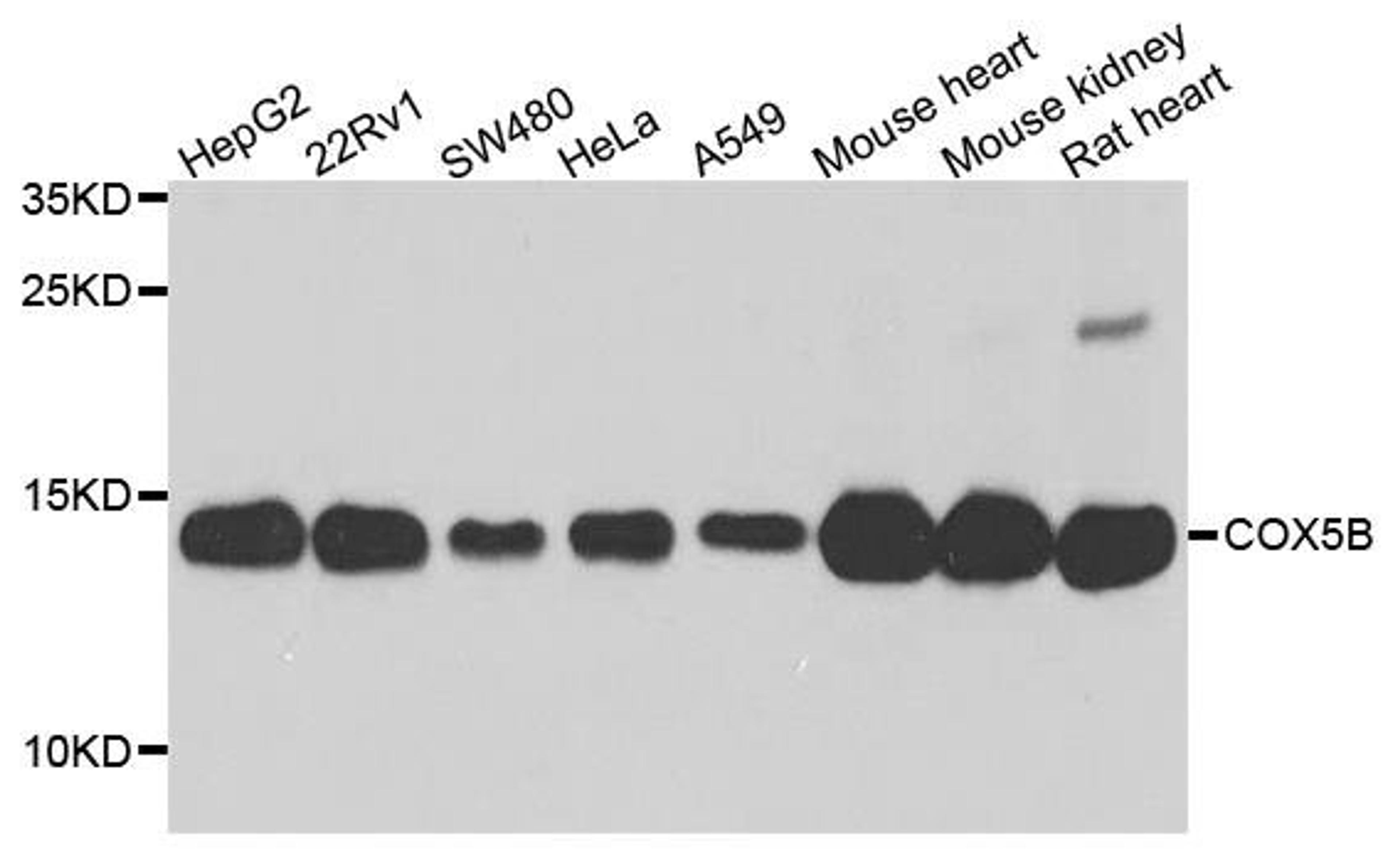 Western blot analysis of extract of various cells using COX5B antibody