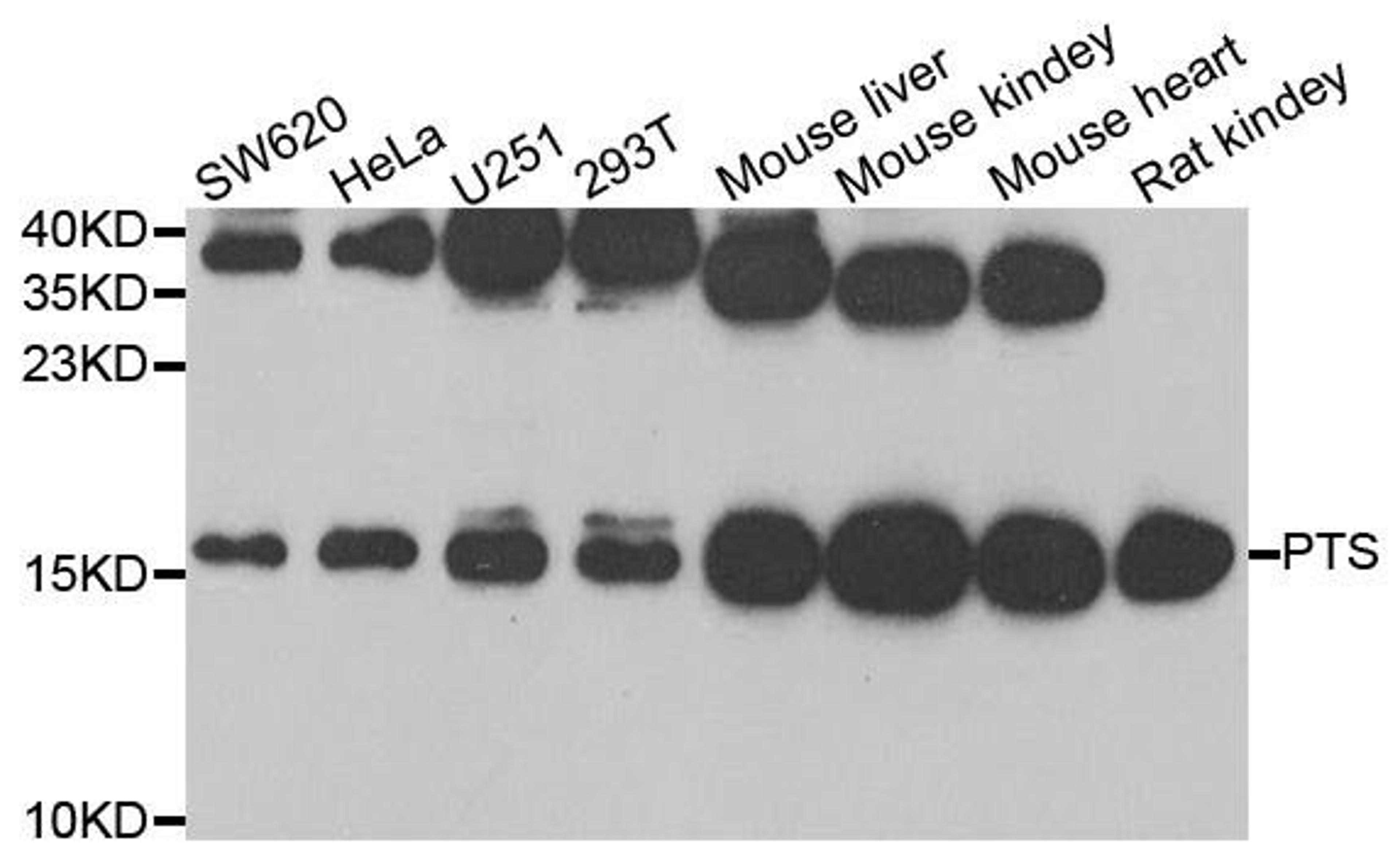 Western blot analysis of extracts of various cell lines using PTS antibody