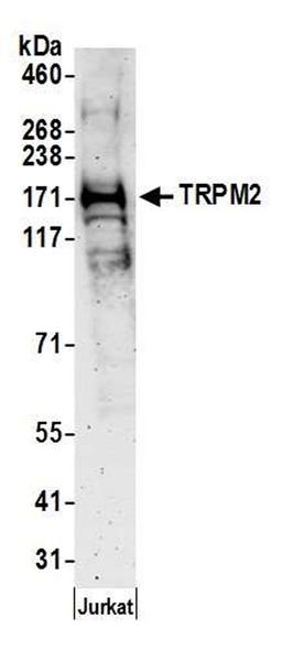 Detection of human TRPM2 by WB.