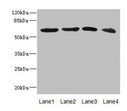 Western blot. All lanes: RGS14 antibody at 3.88ug/ml. Lane 1: 293T whole cell lysate. Lane 2: Hela whole cell lysate. Lane 3: Jurkat whole cell lysate. Lane 4: SH-SY5Y whole cell lysate. Secondary. Goat polyclonal to rabbit IgG at 1/10000 dilution. Predicted band size: 62, 22, 45, 37 kDa. Observed band size: 62 kDa. 