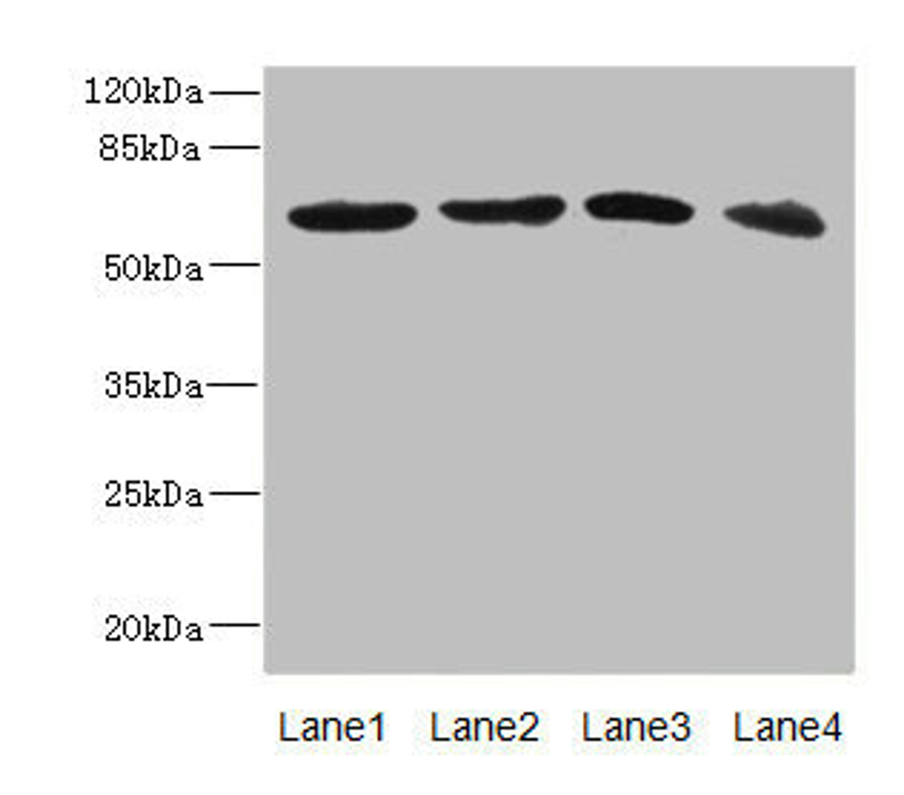Western blot. All lanes: RGS14 antibody at 3.88ug/ml. Lane 1: 293T whole cell lysate. Lane 2: Hela whole cell lysate. Lane 3: Jurkat whole cell lysate. Lane 4: SH-SY5Y whole cell lysate. Secondary. Goat polyclonal to rabbit IgG at 1/10000 dilution. Predicted band size: 62, 22, 45, 37 kDa. Observed band size: 62 kDa. 