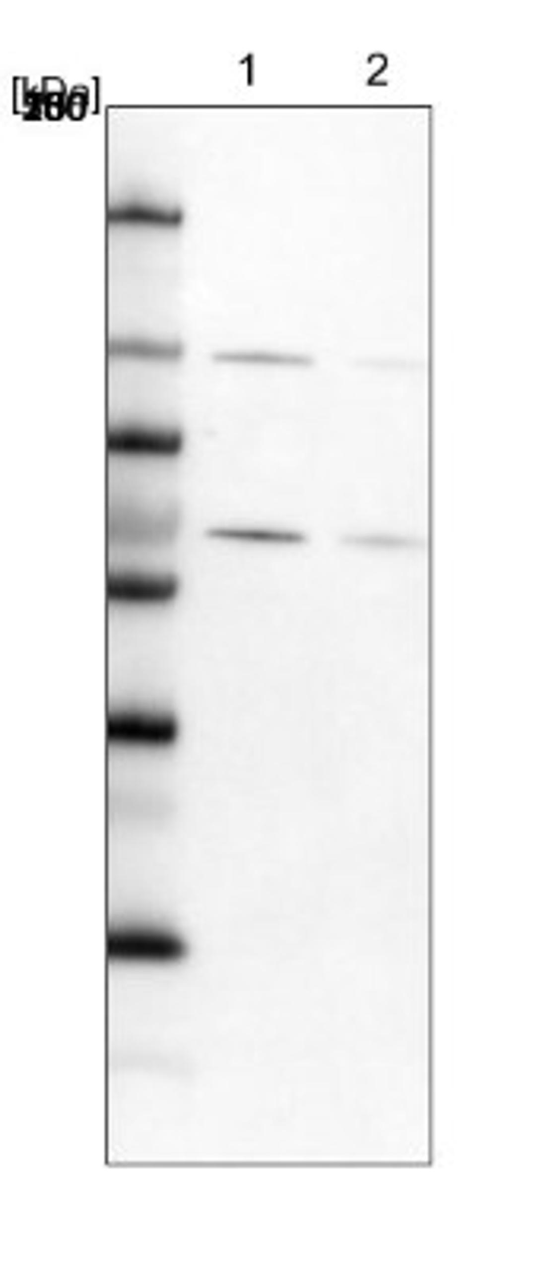 Western Blot: RBM19 Antibody [NBP1-84135] - Lane 1: NIH-3T3 cell lysate (Mouse embryonic fibroblast cells)<br/>Lane 2: NBT-II cell lysate (Rat Wistar bladder tumour cells)